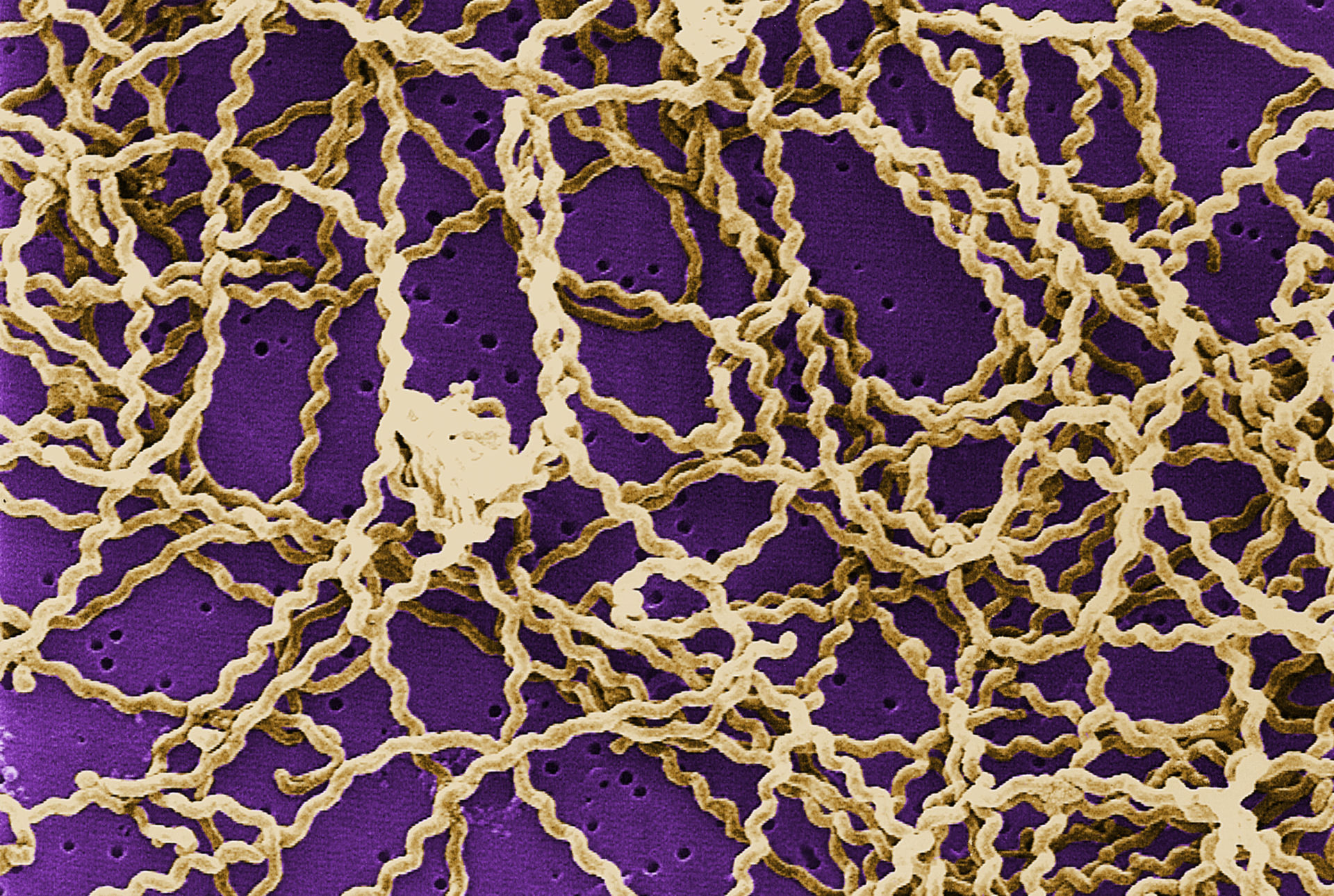 Leptospira sp. bacteria atop a 0.1. µm polycarbonate filter