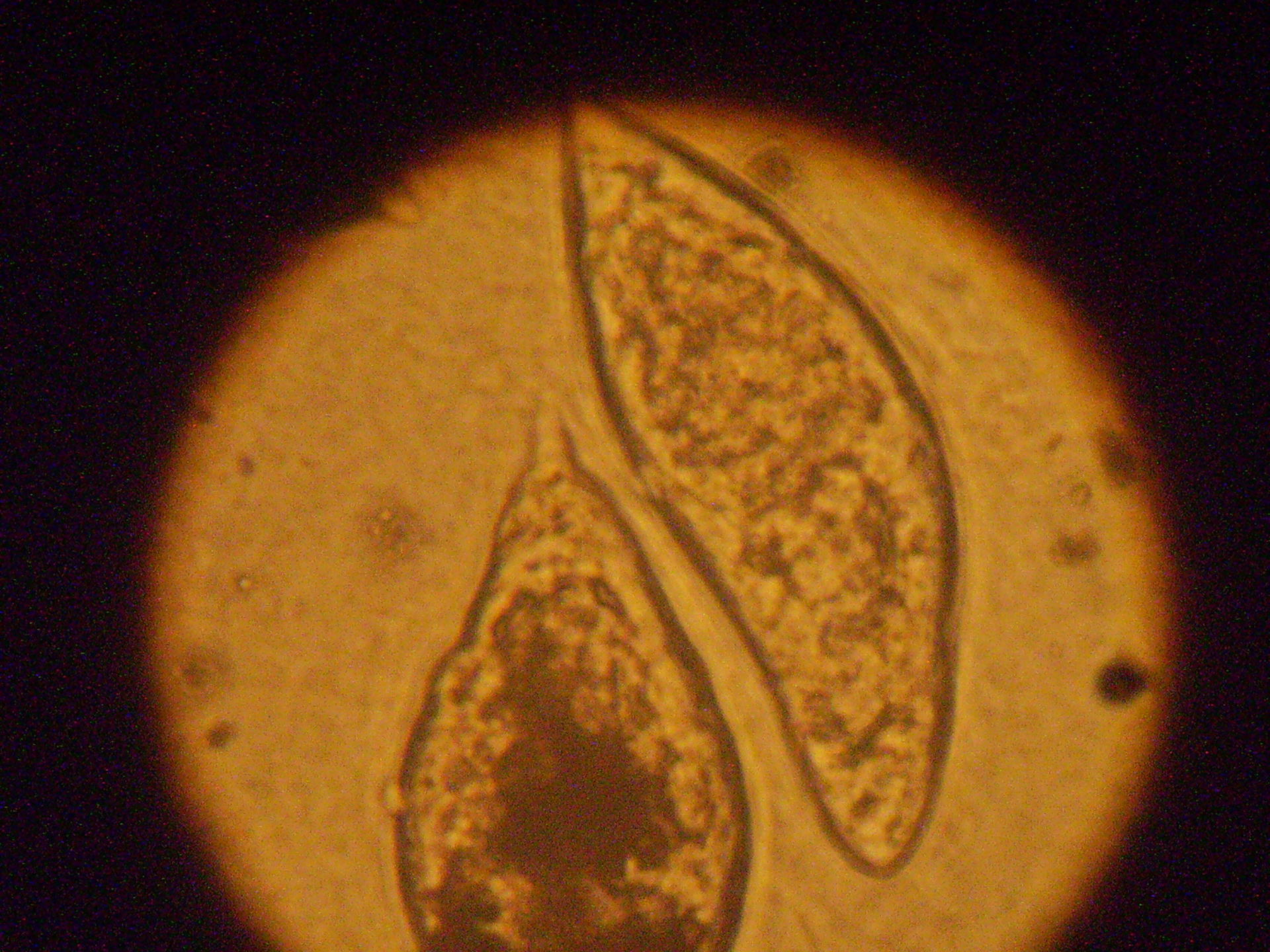 Schistosoma haematatum a