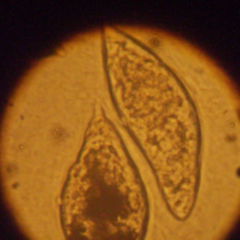 schistosomiasis doccheck)