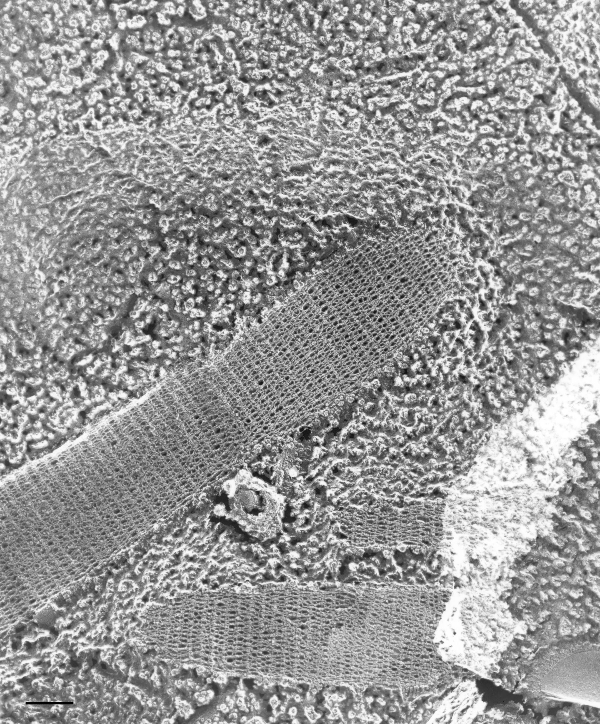 Paramecium multimicronucleatum (Trichocyst) - CIL:36685