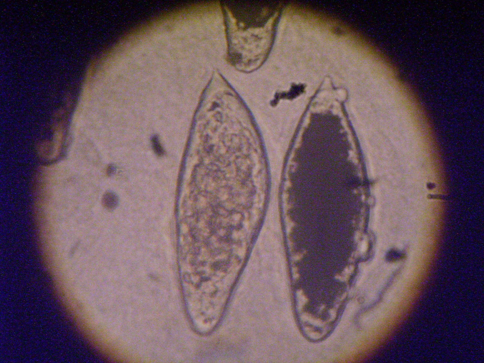 Schistoma haematobium