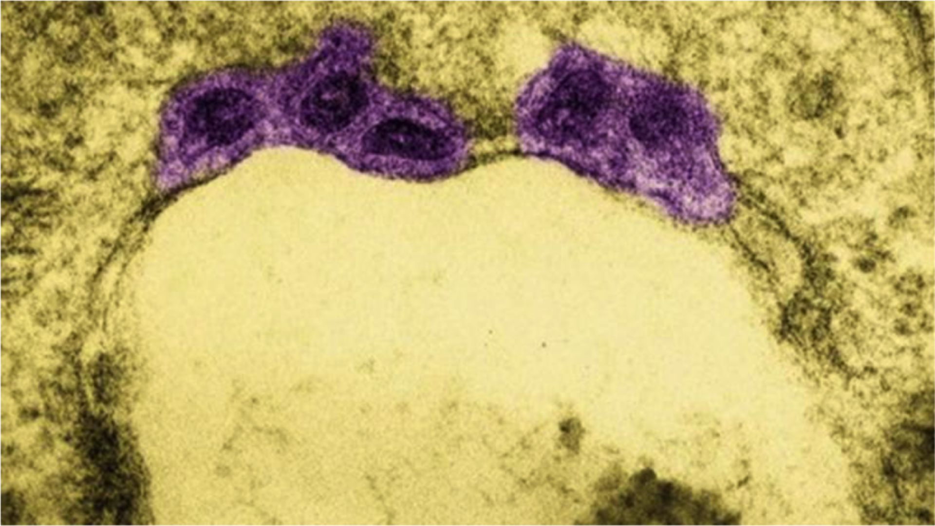 Influenza-Viren in einer infizierten Zelle