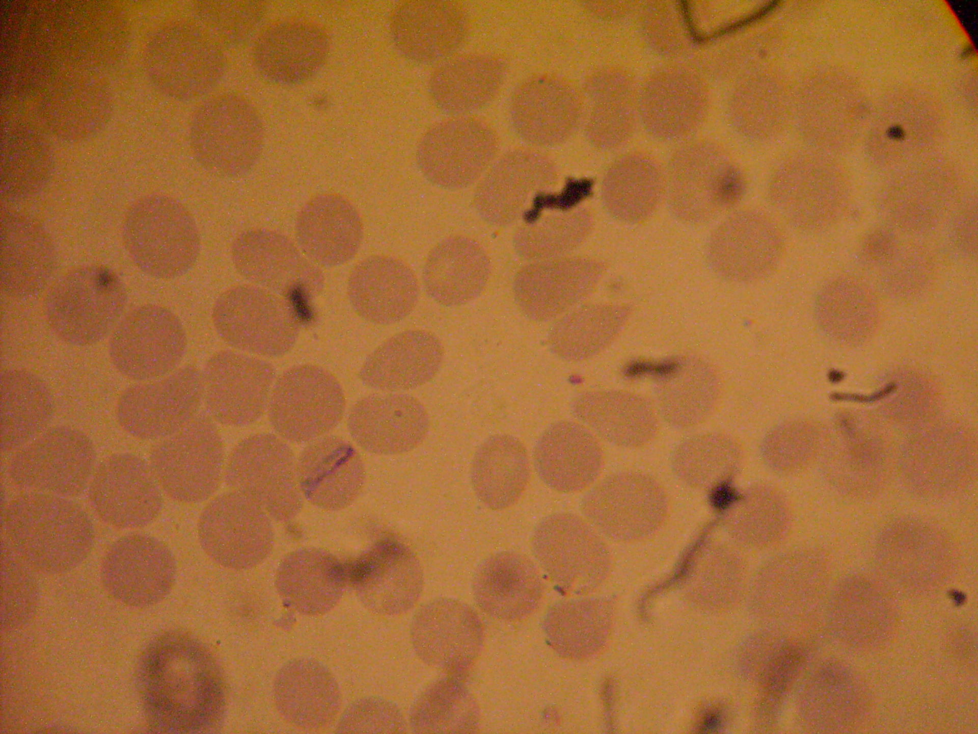 Plasmodium malariae trophozoit