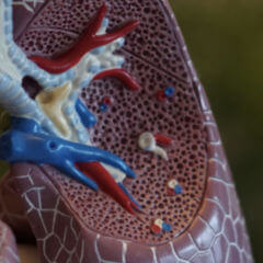 Rekonvaleszenz DocCheck Flexikon