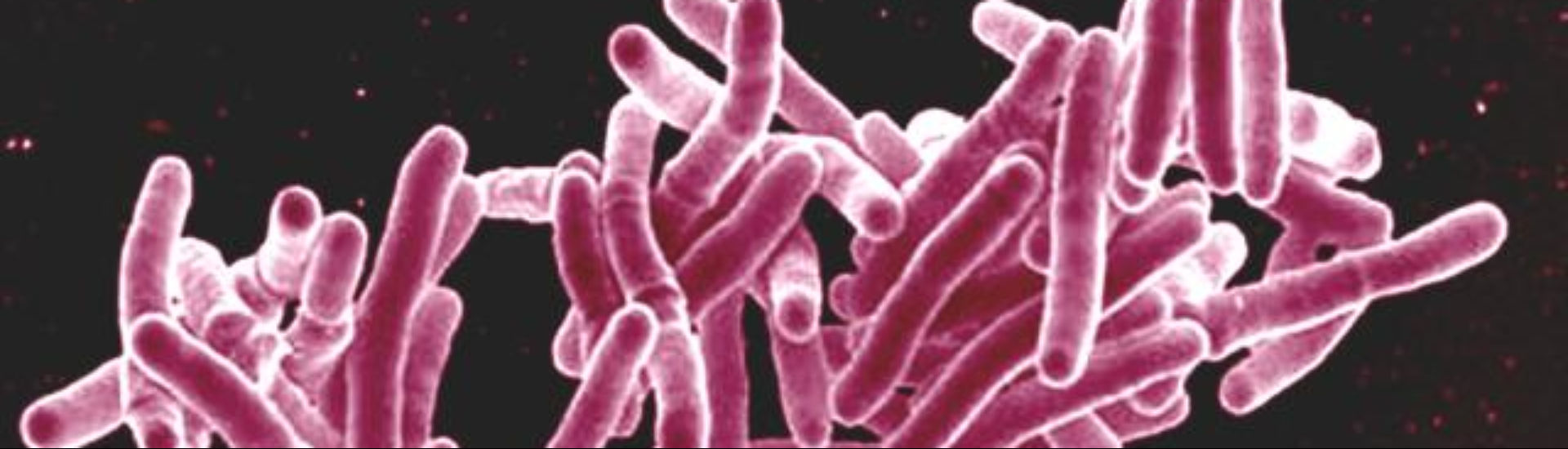 Tuberkulose: Tipps gegen latente Unsicherheit - DocCheck