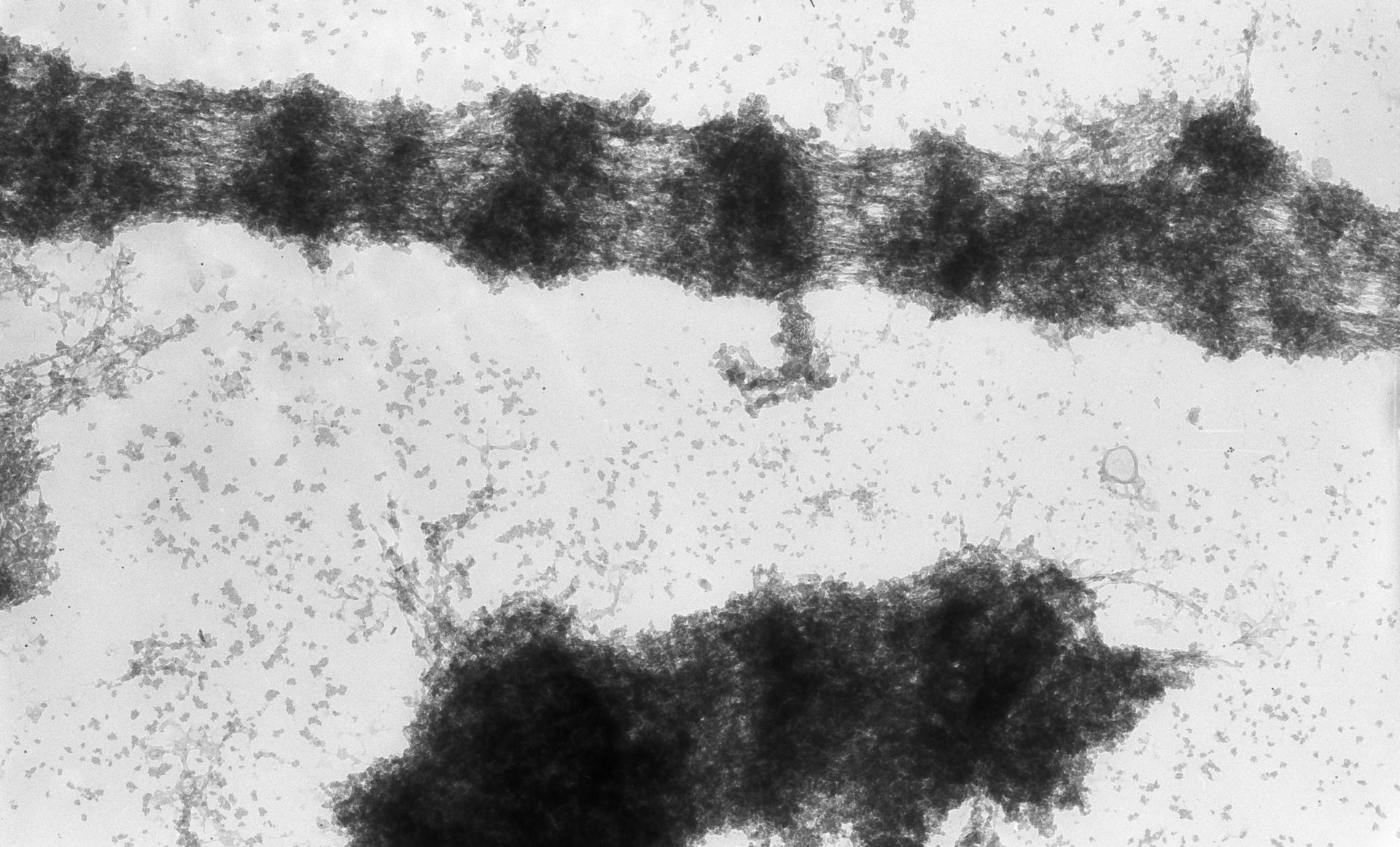 Drosophila melanogaster (Polytene chromosome) - CIL:25309