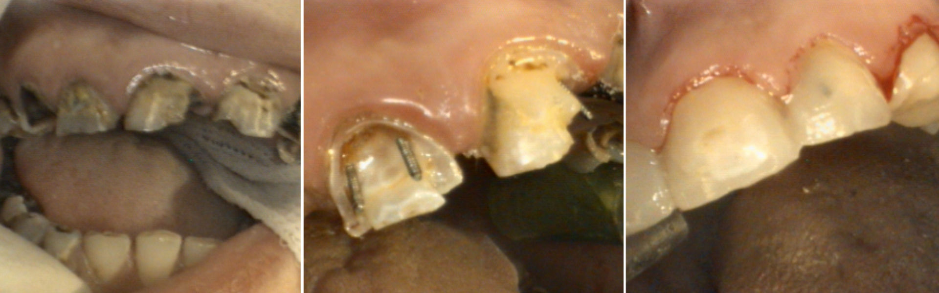 Zahnsanierung I