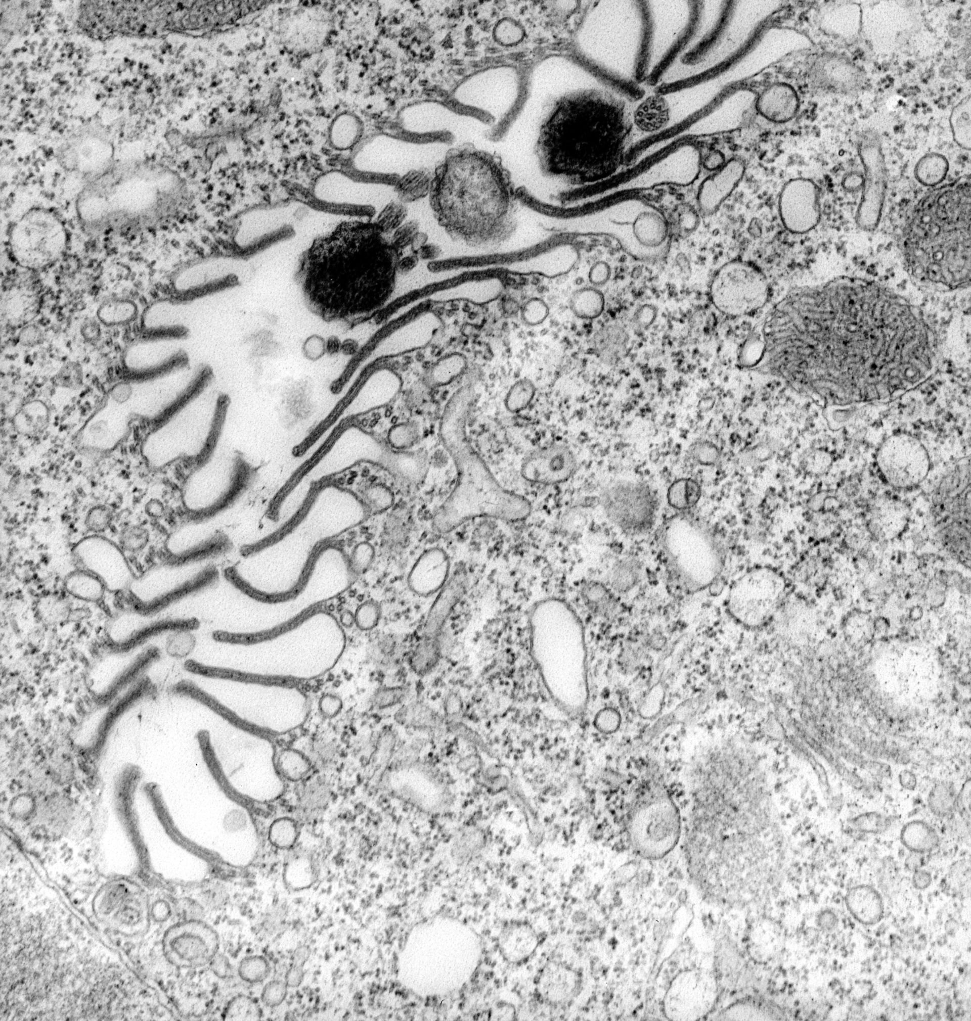Vorticella convallaria (Plasma membrane) - CIL:39460