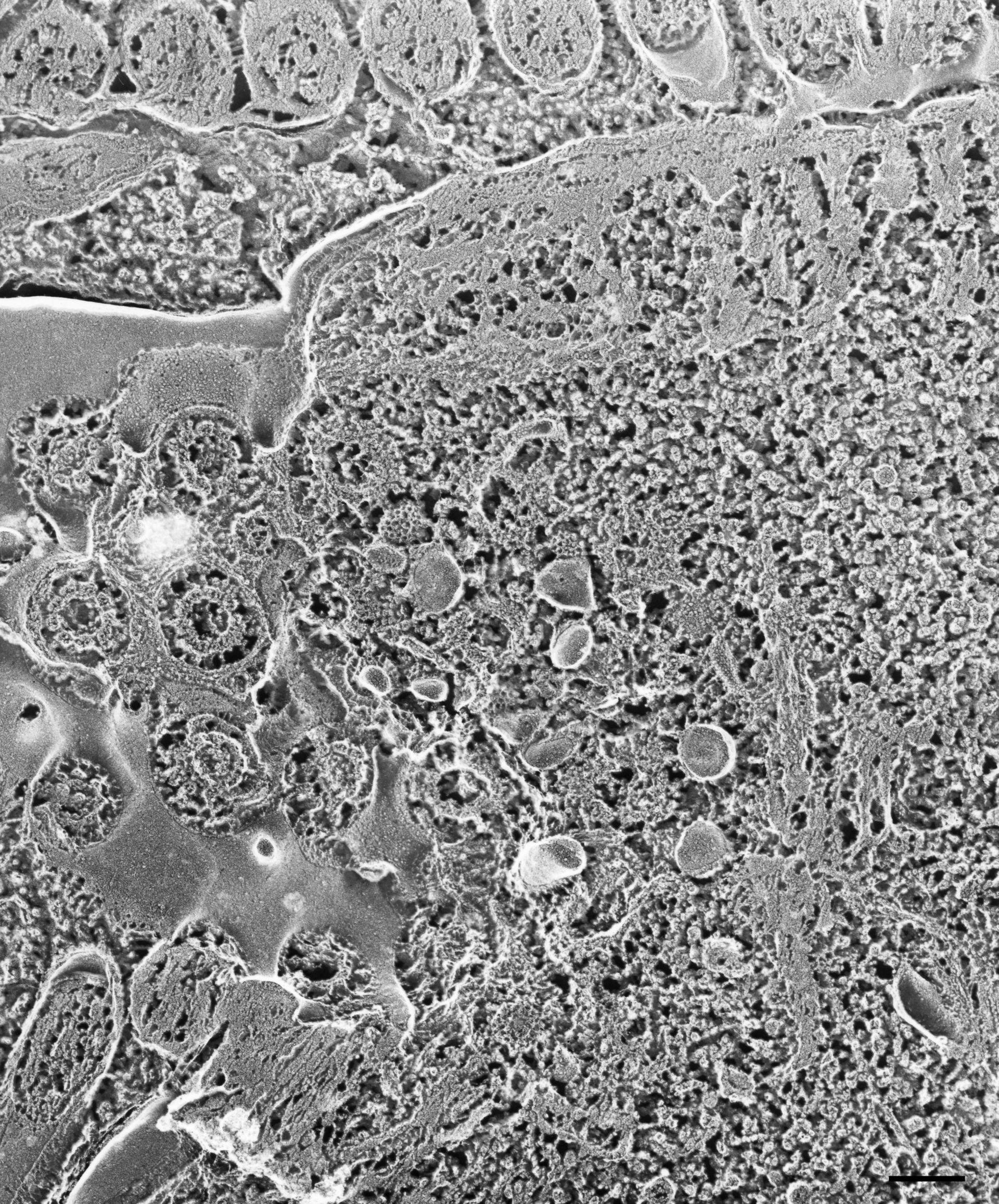 Paramecium multimicronucleatum (Vesicle membrane) - CIL:21652