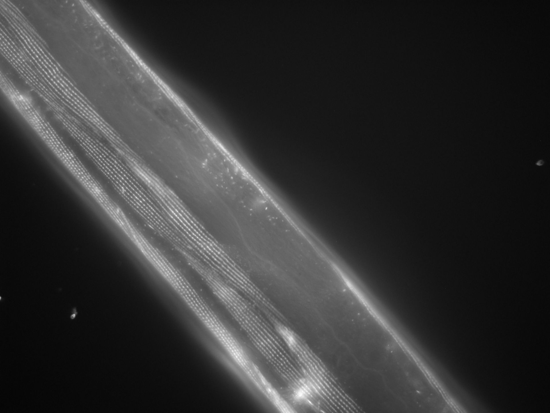 Caenorhabditis elegans (Actin filament) - CIL:1018