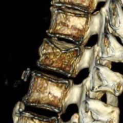 BWK - DocCheck Flexikon