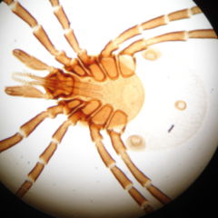 Ixodes hexagonus DocCheck Flexikon