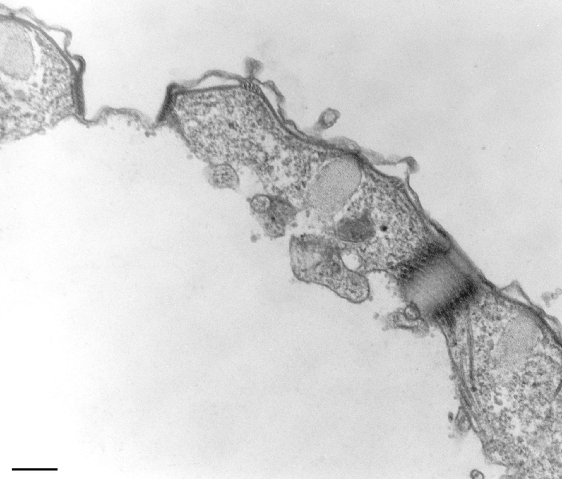 Tetrahymena pyriformis (Cell cortex) - CIL:36233