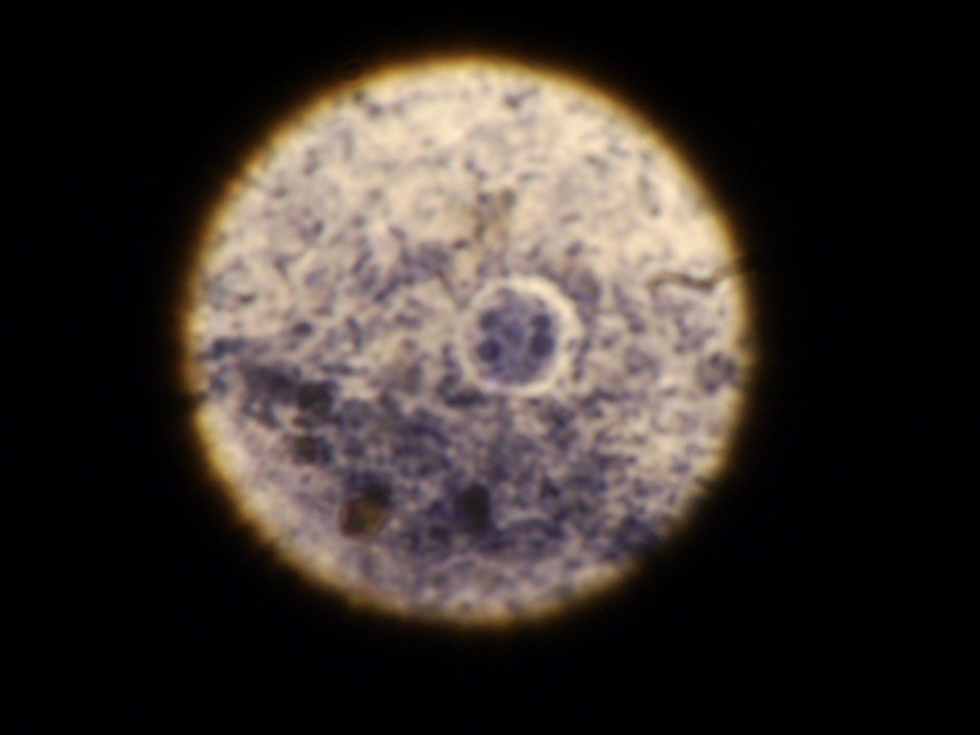 Entamoeba histolytica