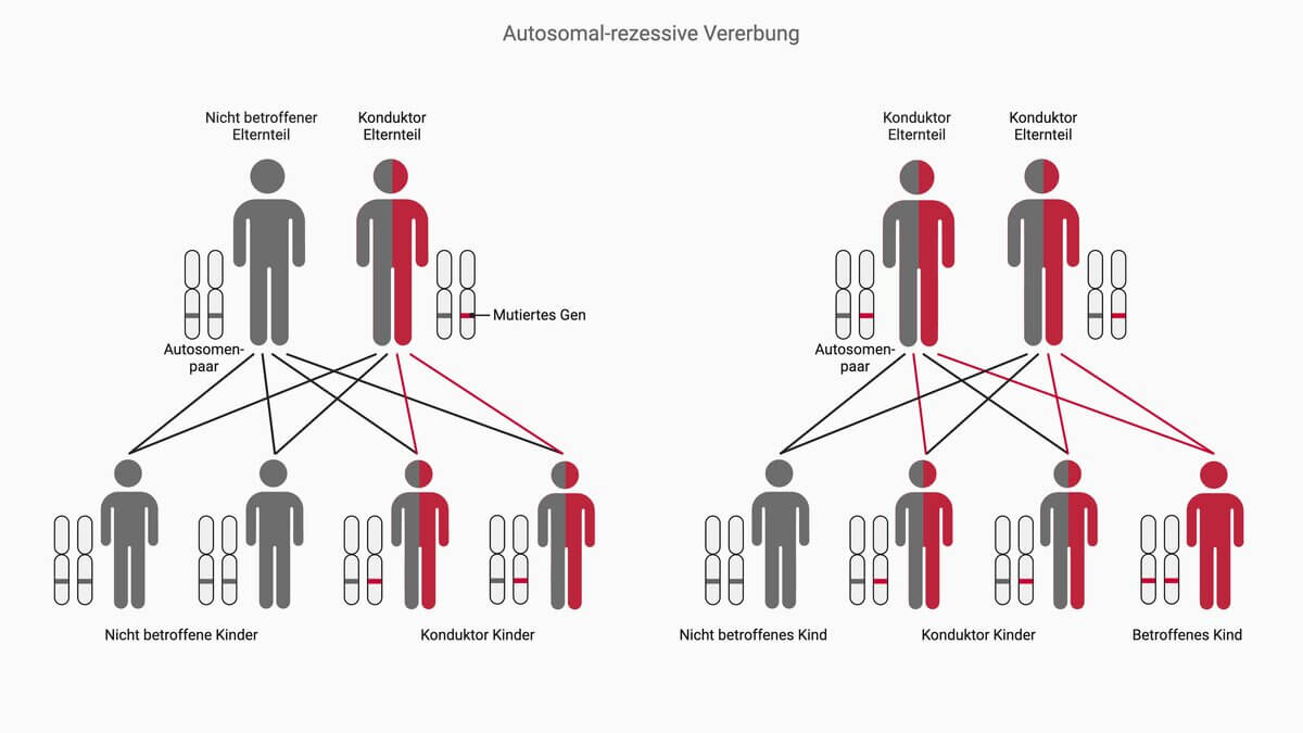 Autosomal-rezessiver Erbgang