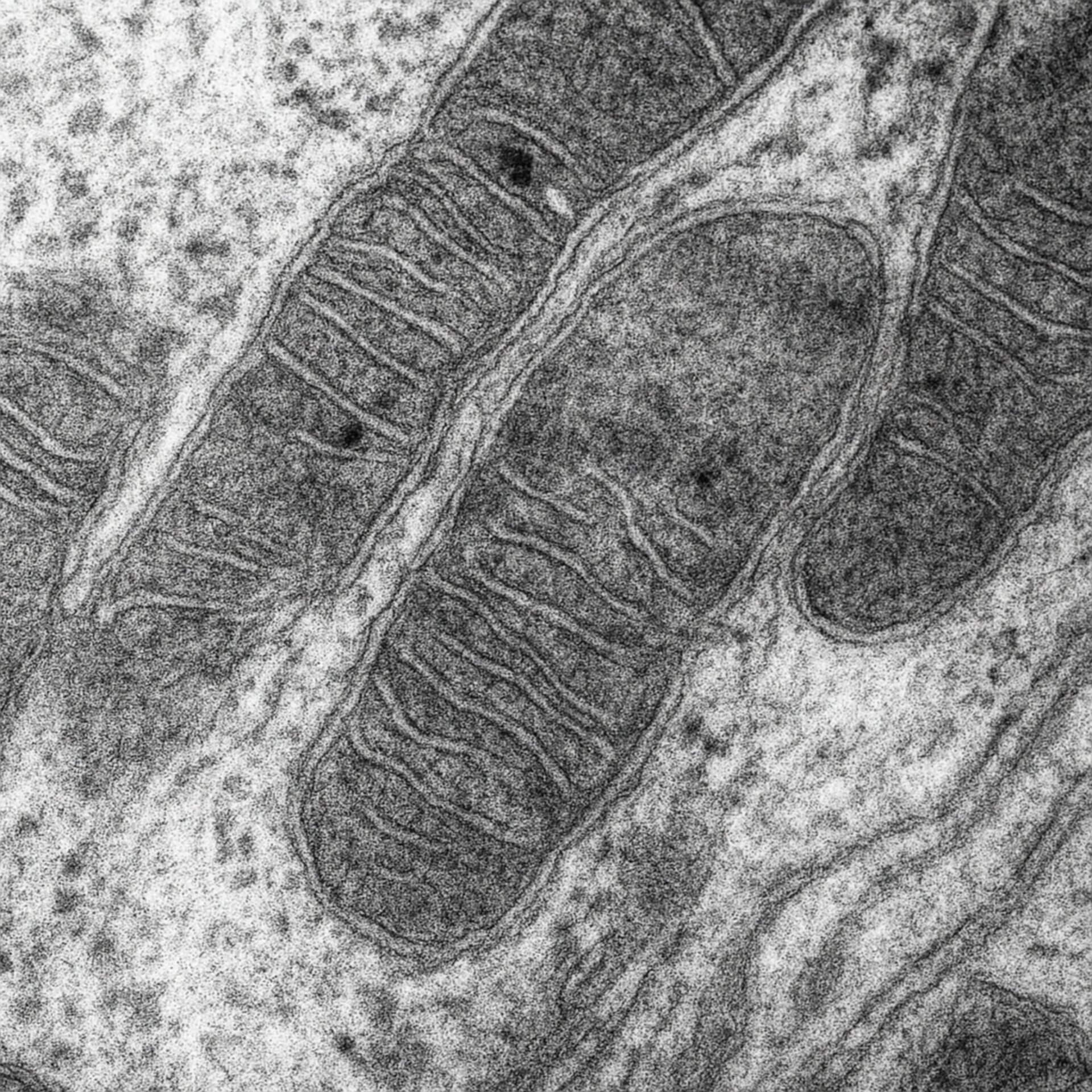 Elektronenmikroskopie