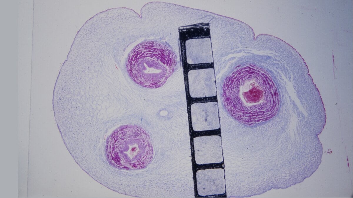 Histologie Nabelschnur