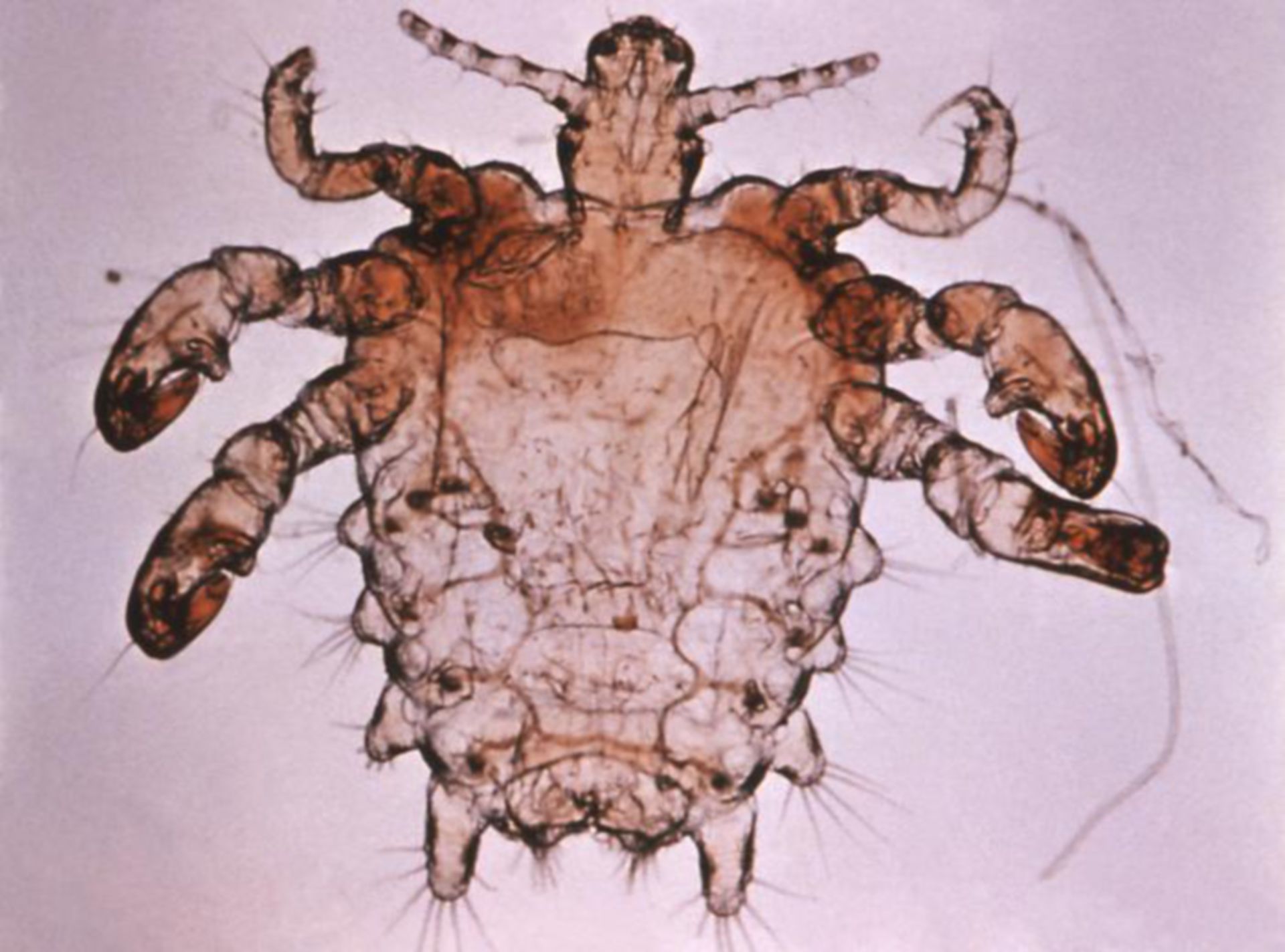 Pthius pubis - crab louse Sackratte