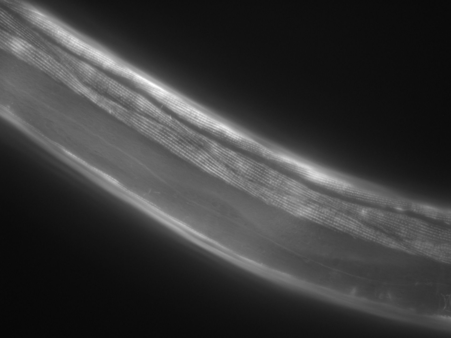 Caenorhabditis elegans (Actin filament) - CIL:1046