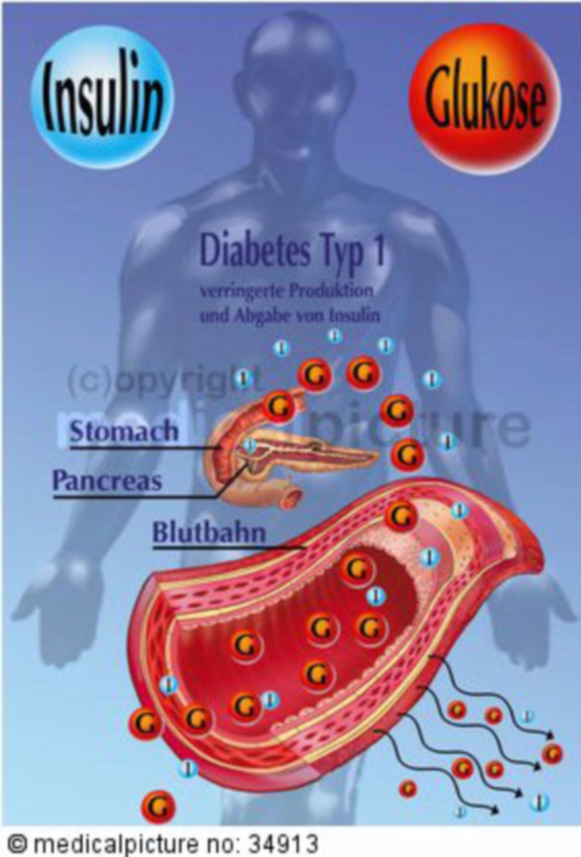 Insulin secretion of people with type I diabetes