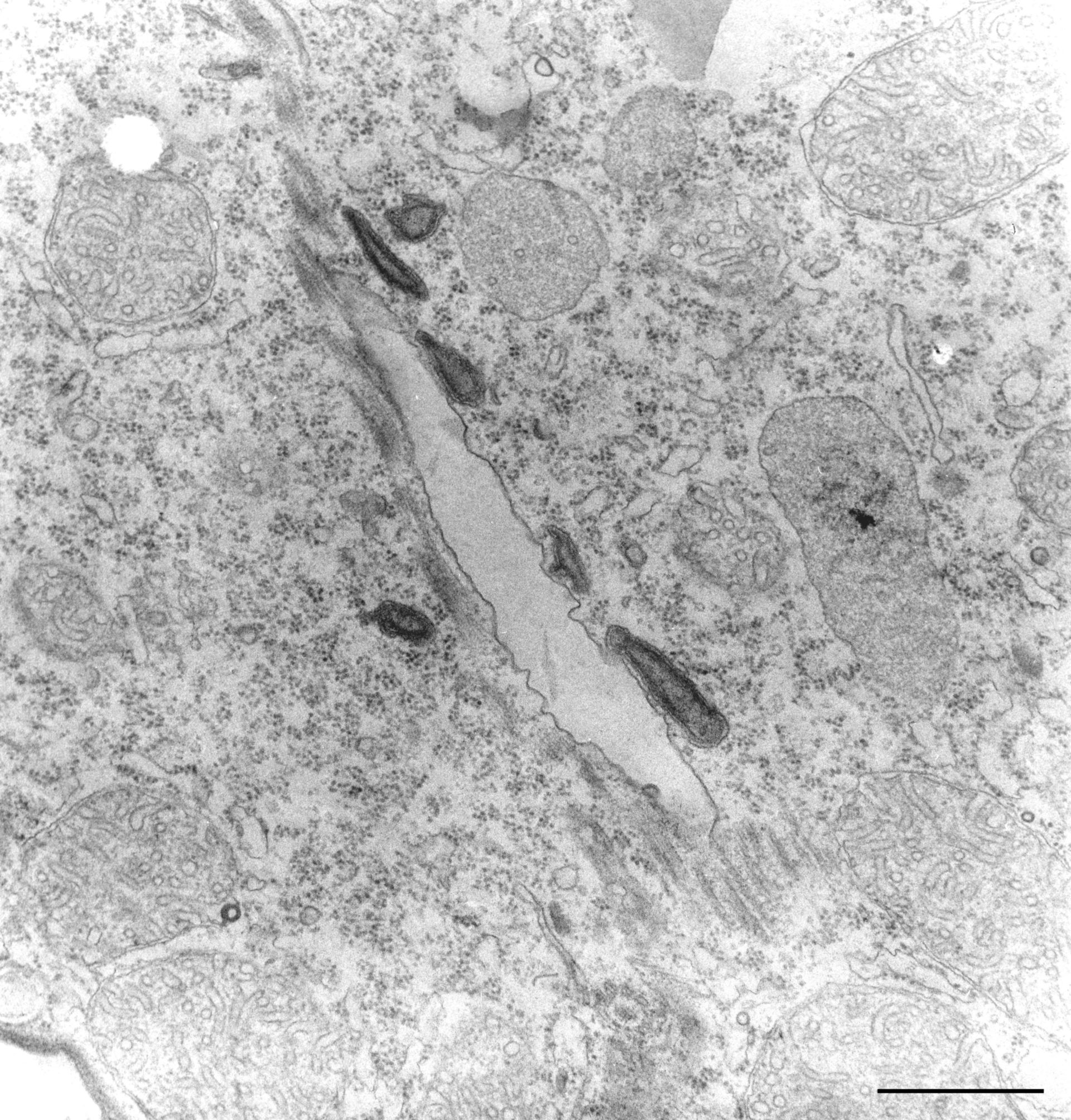 Tetrahymena pyriformis (Acidosome) - CIL:36228