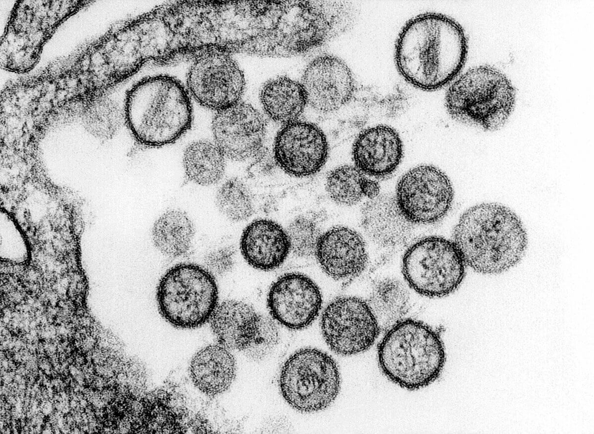 Sin-Nombre-Virus