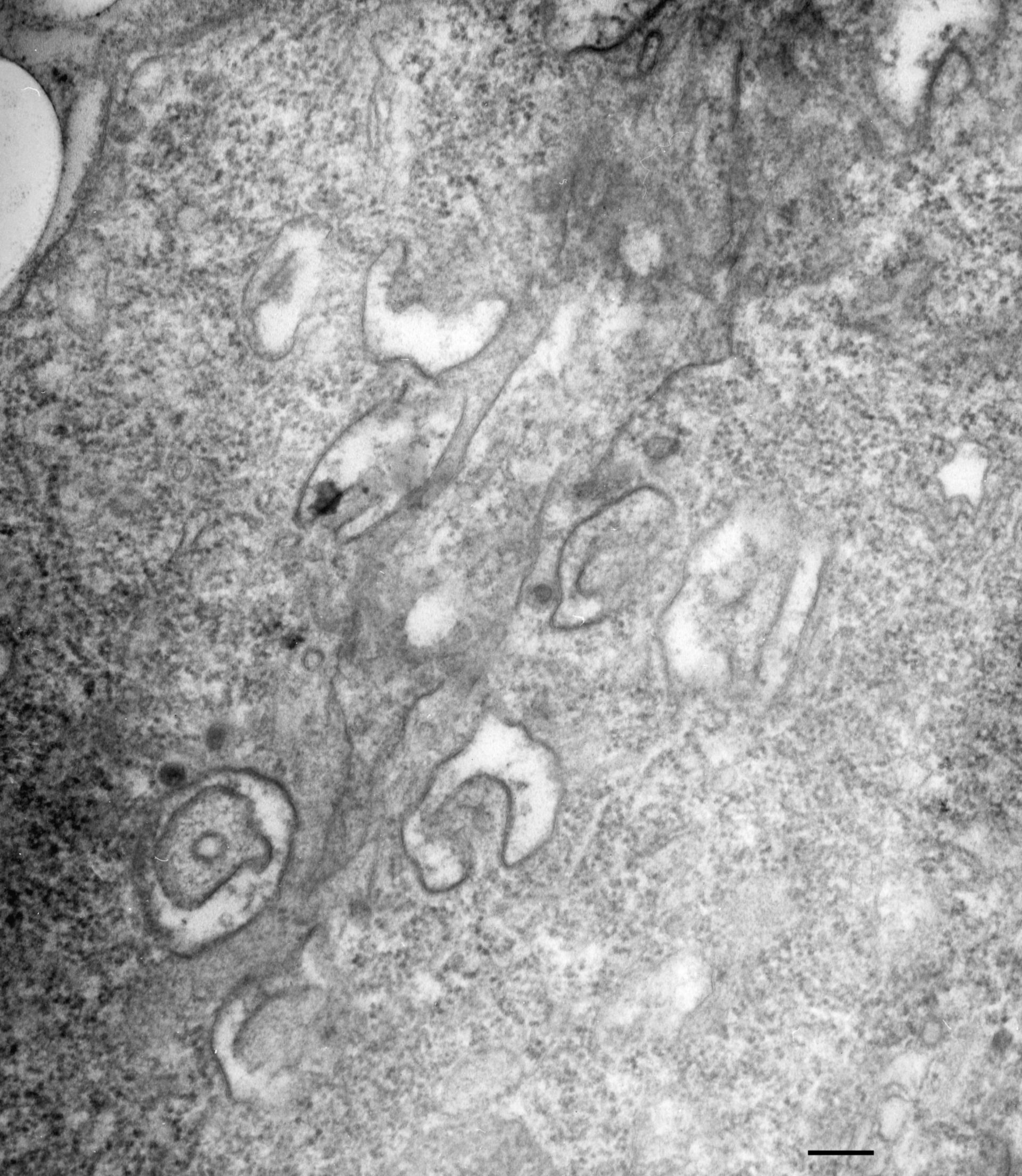 Paramecium multimicronucleatum (Early endosome) - CIL:36717