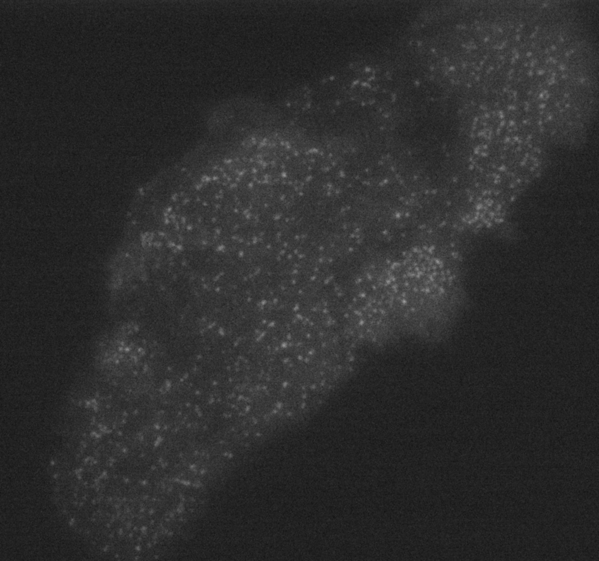 Homo sapiens (Clathrin light chain) - CIL:11861