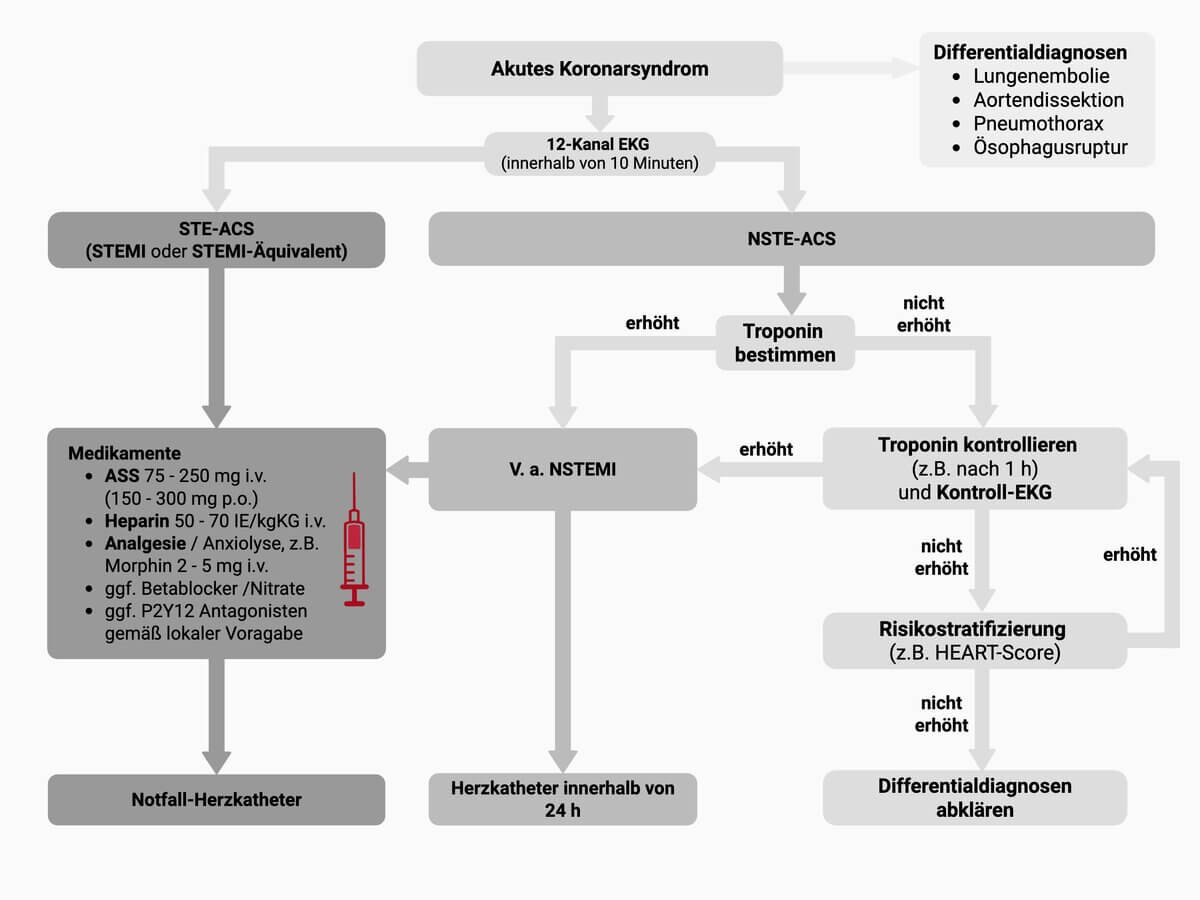 Therapiealgorithmus Akutes Koronarsyndrom