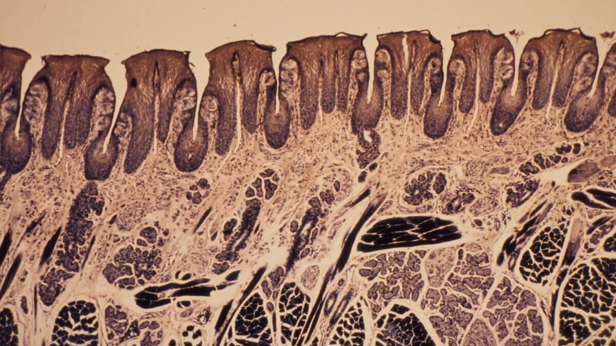 Papillae foliatae der Zunge