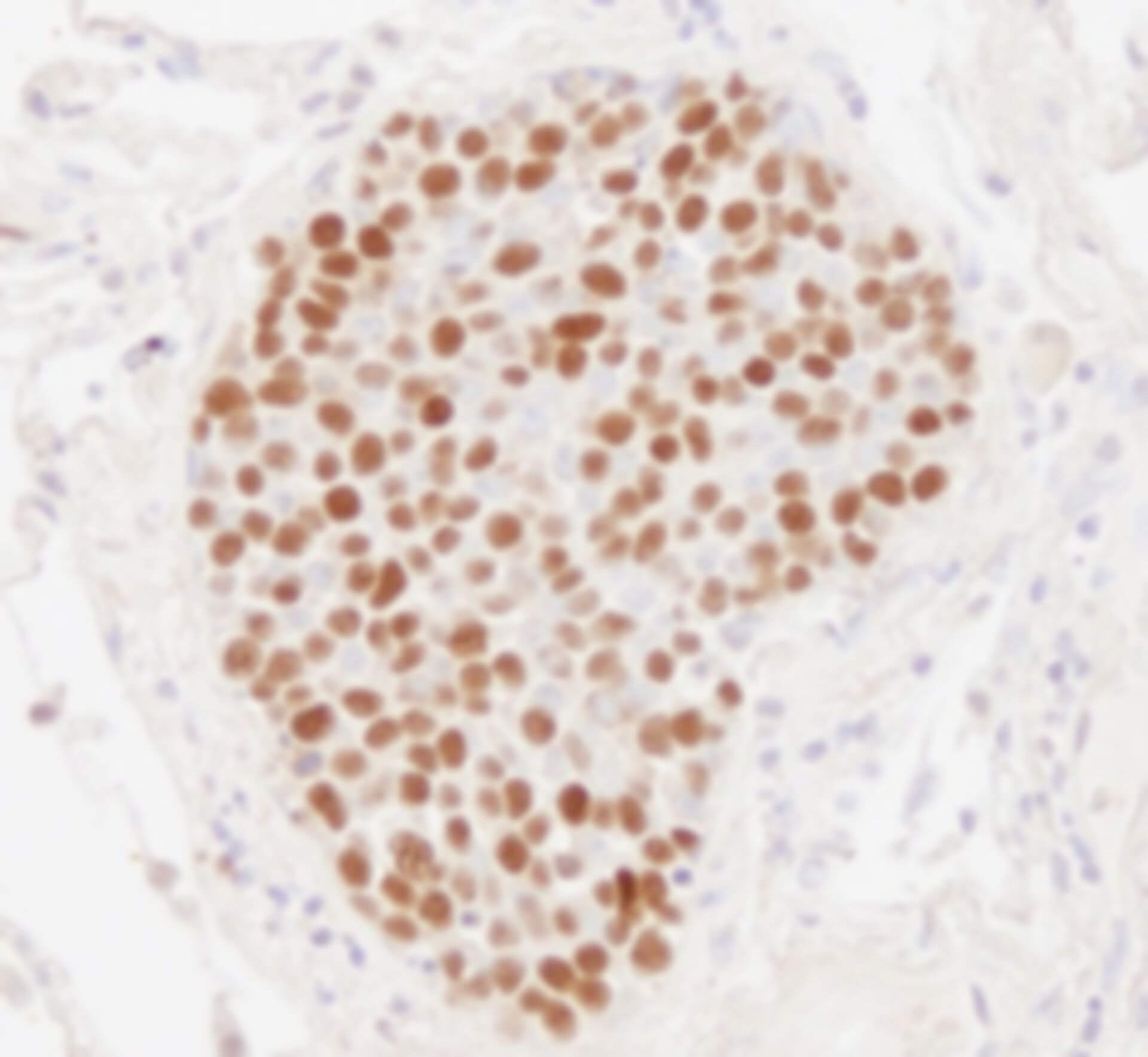 Cell Proliferation Assay with Immunoassay