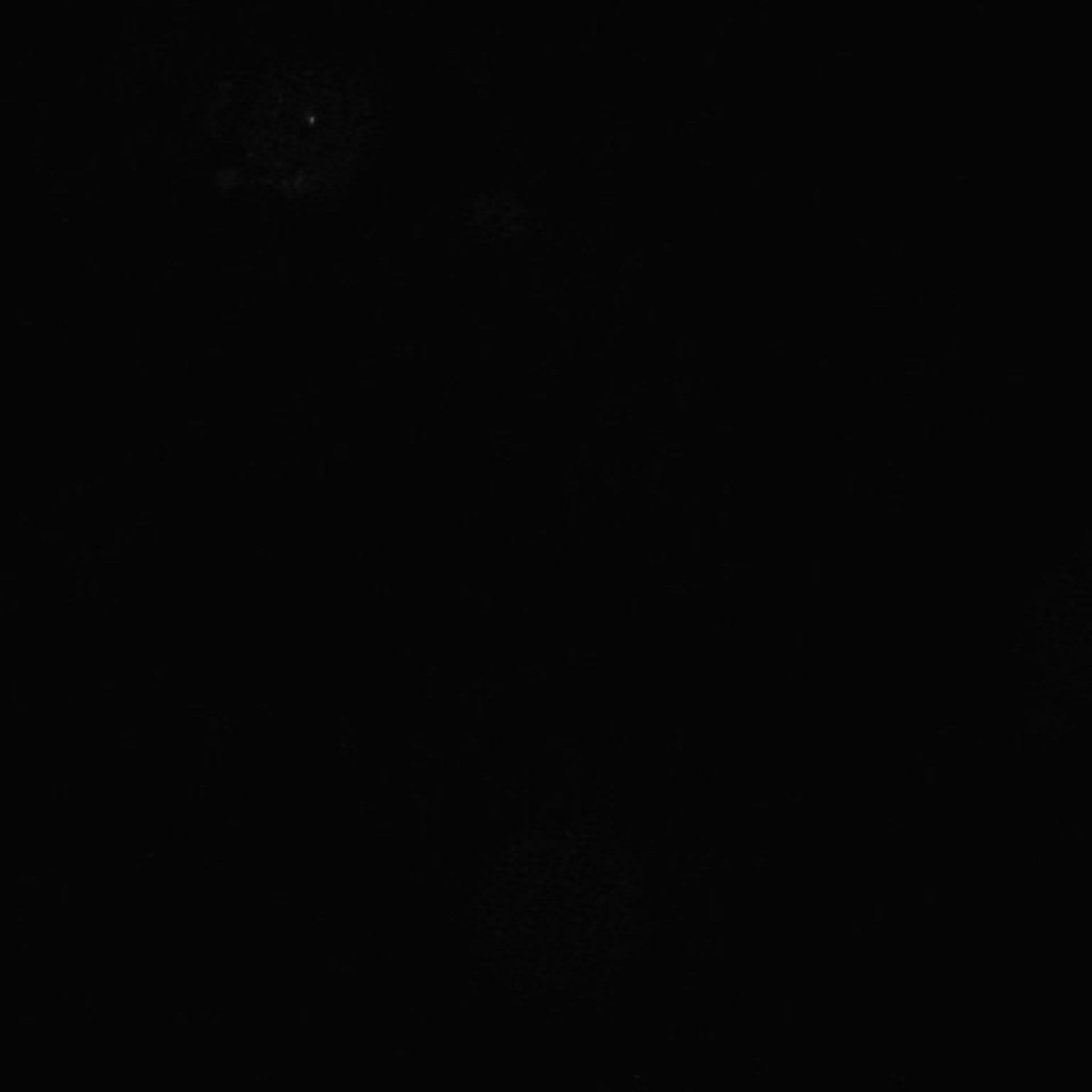 Xenopus laevis (Axon) - CIL:36992
