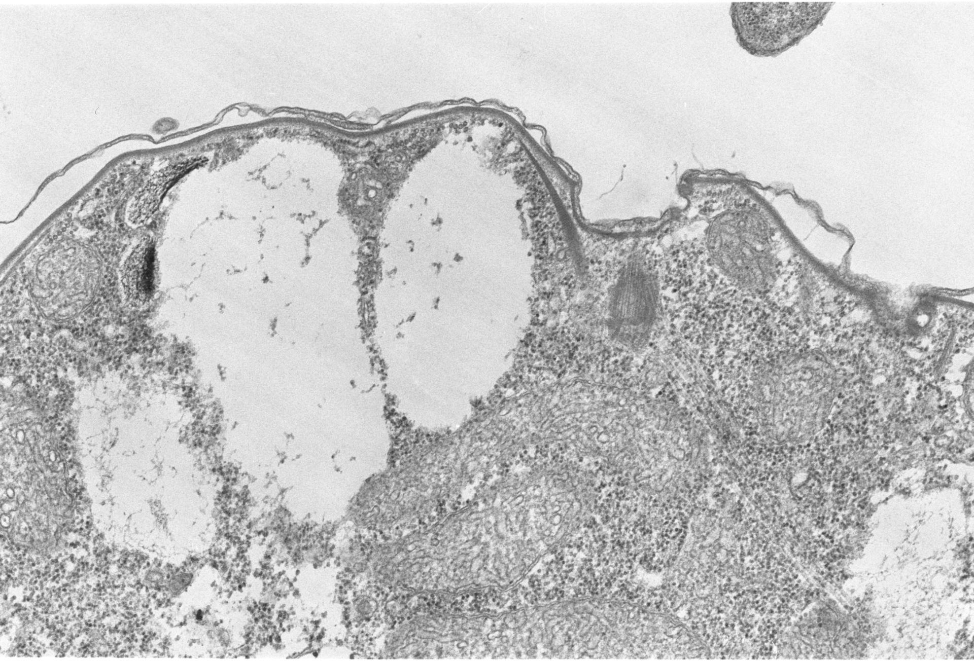 Colpoda cucullus (Epiplasm) - CIL:2857