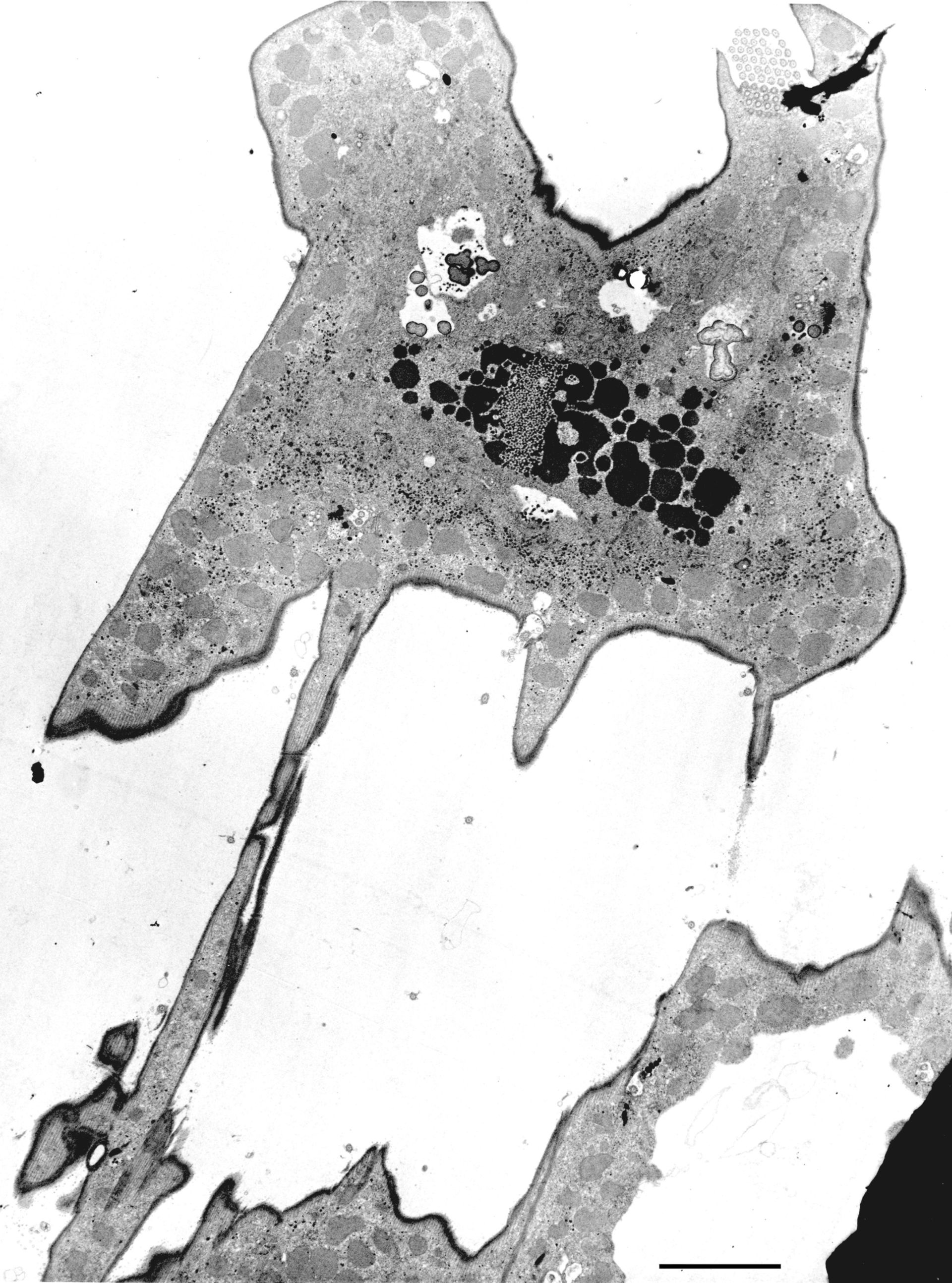 Euplotes sp. (Contractile vacuole) - CIL:12331