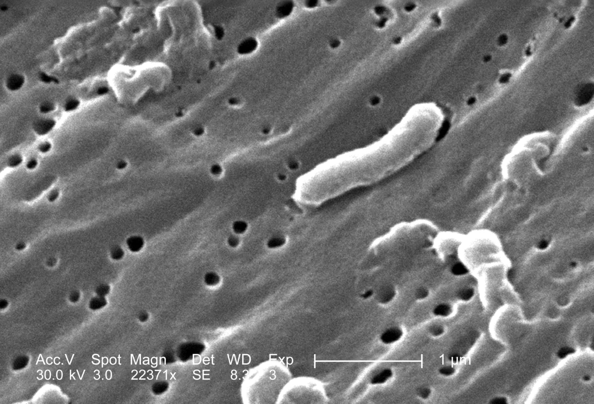 Cholera-Bakterien (Vibrio cholerae, Elektronenmikroskopie)