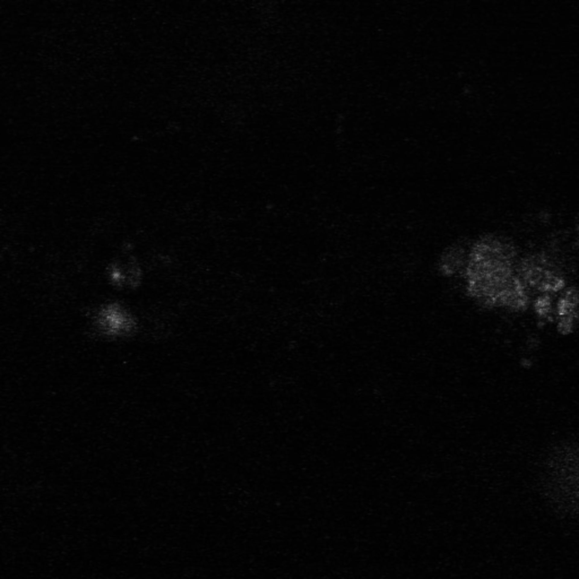 Xenopus laevis (Axon) - CIL:37050