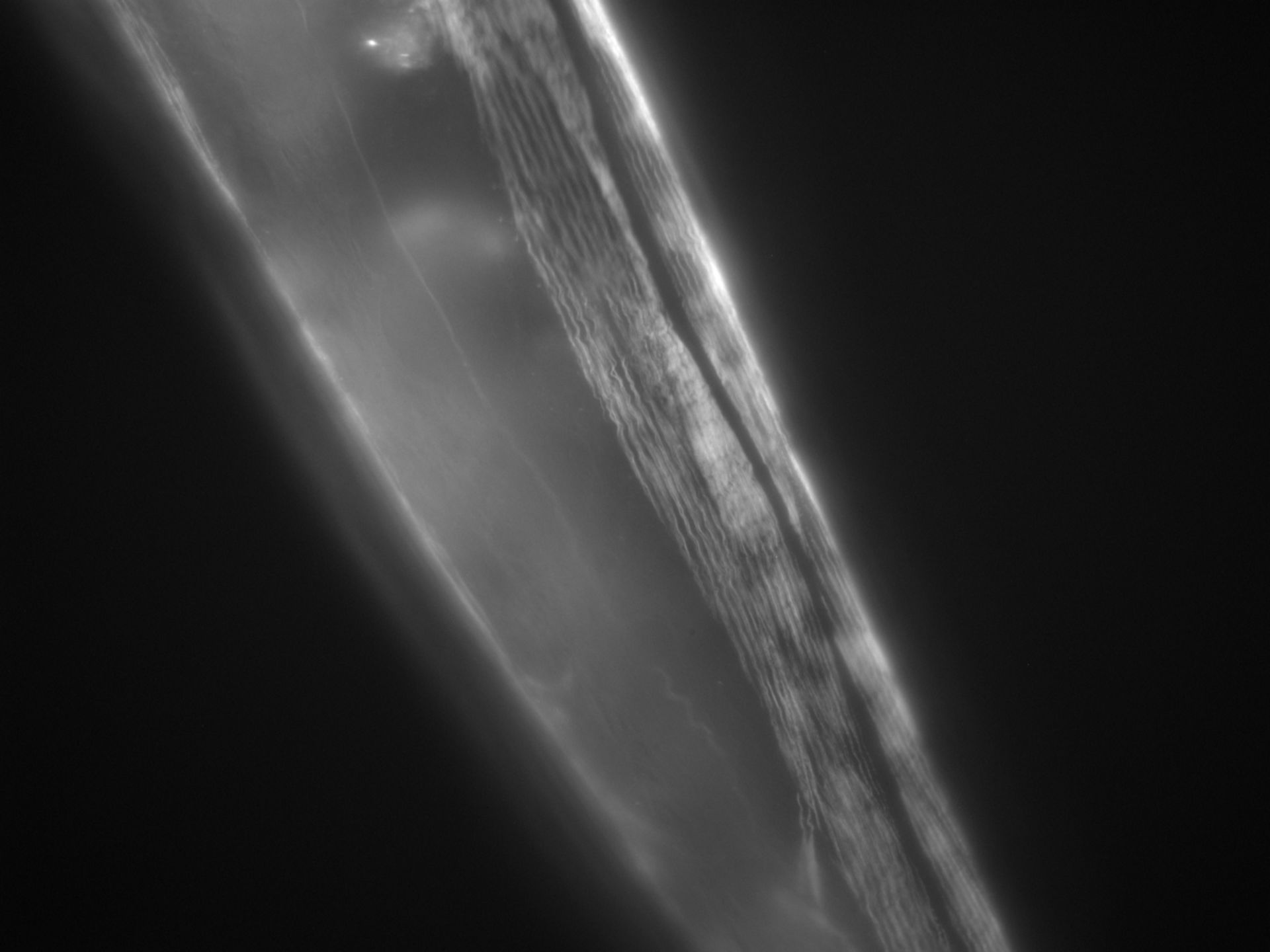 Caenorhabditis elegans (Actin filament) - CIL:1288