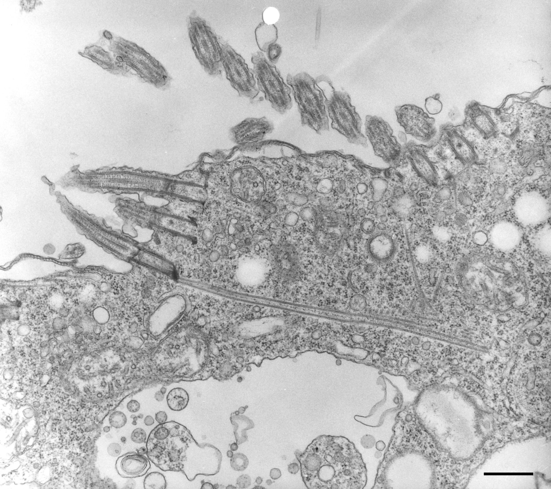 Halteria grandinella (Microtubule cytoskeleton) - CIL:10274