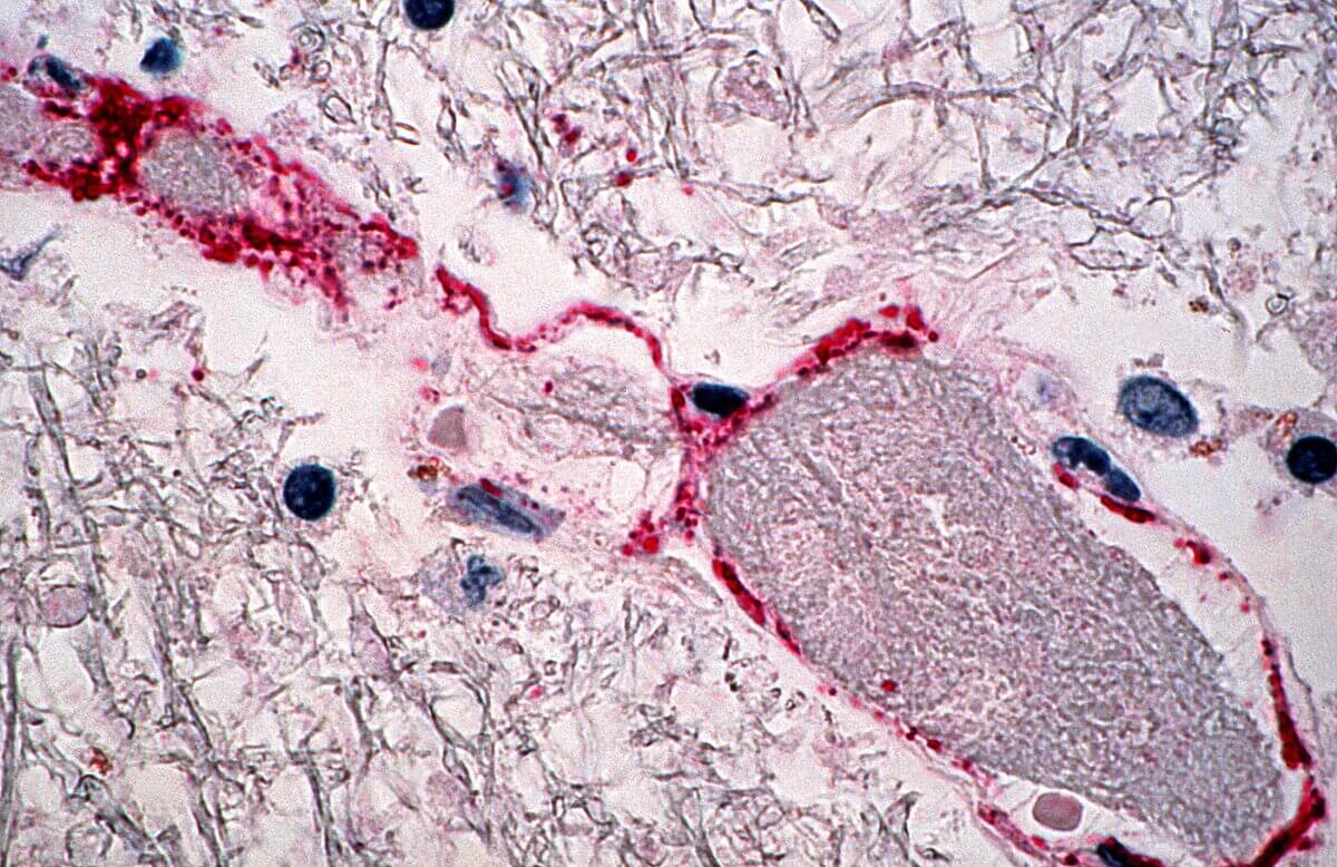 Nipah-Virus