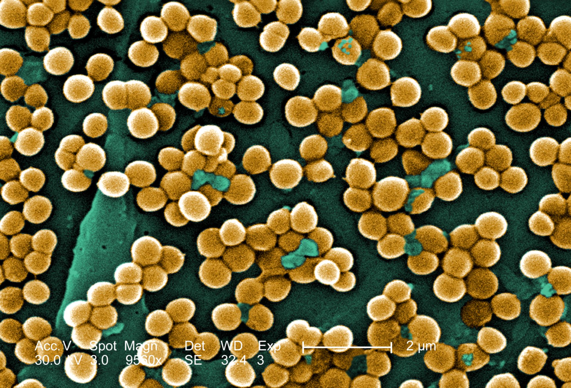 Staphylococcus aureus (MRSA, Rasterelektronenmikroskop)