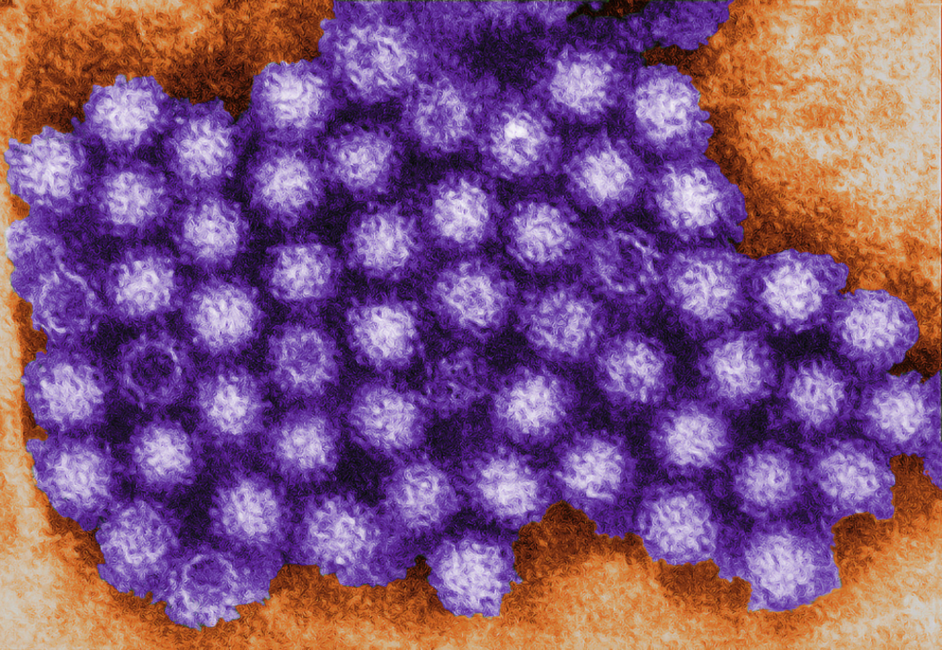 Norovirus (TEM, koloriert)