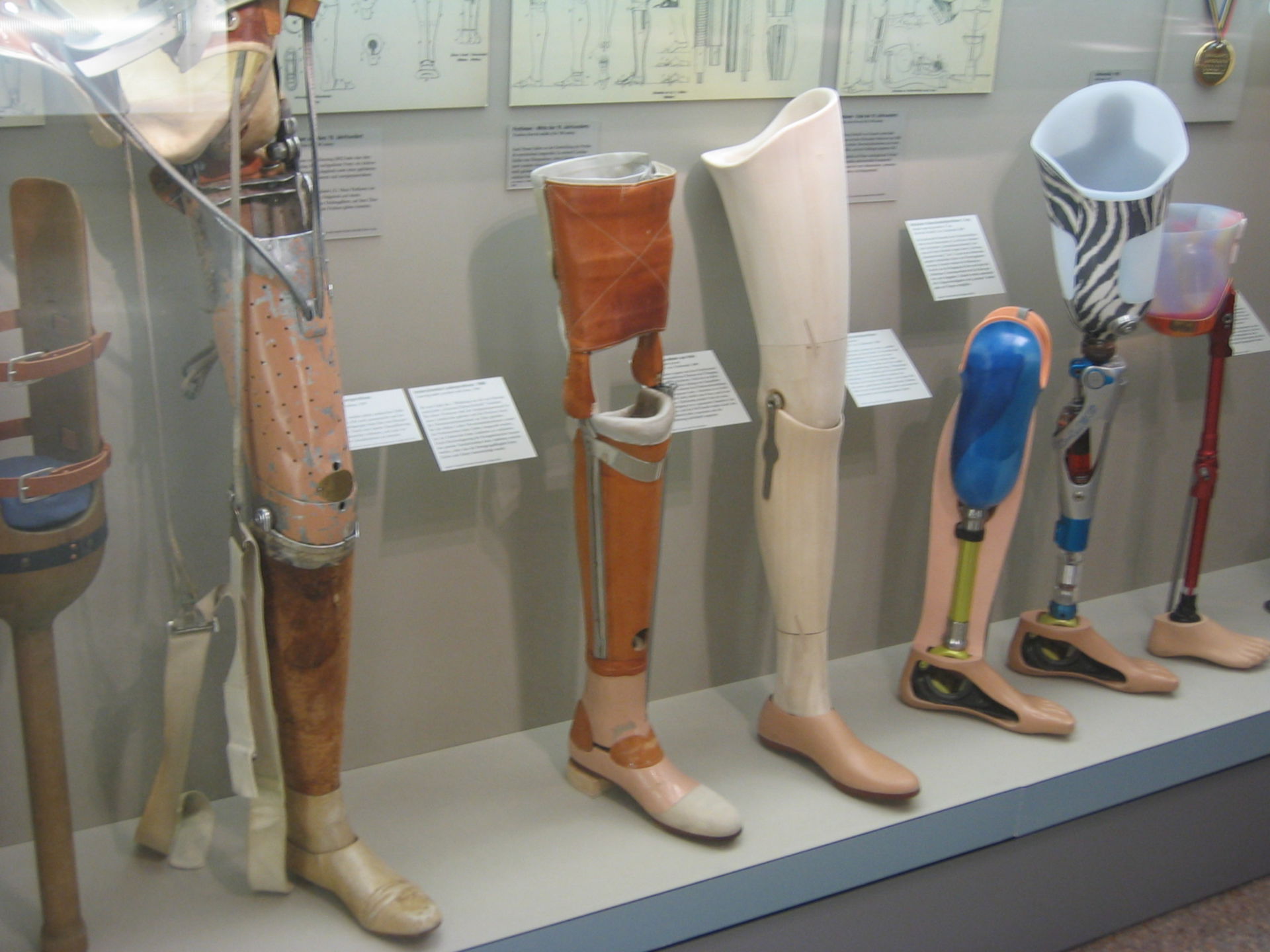 historical prostheses