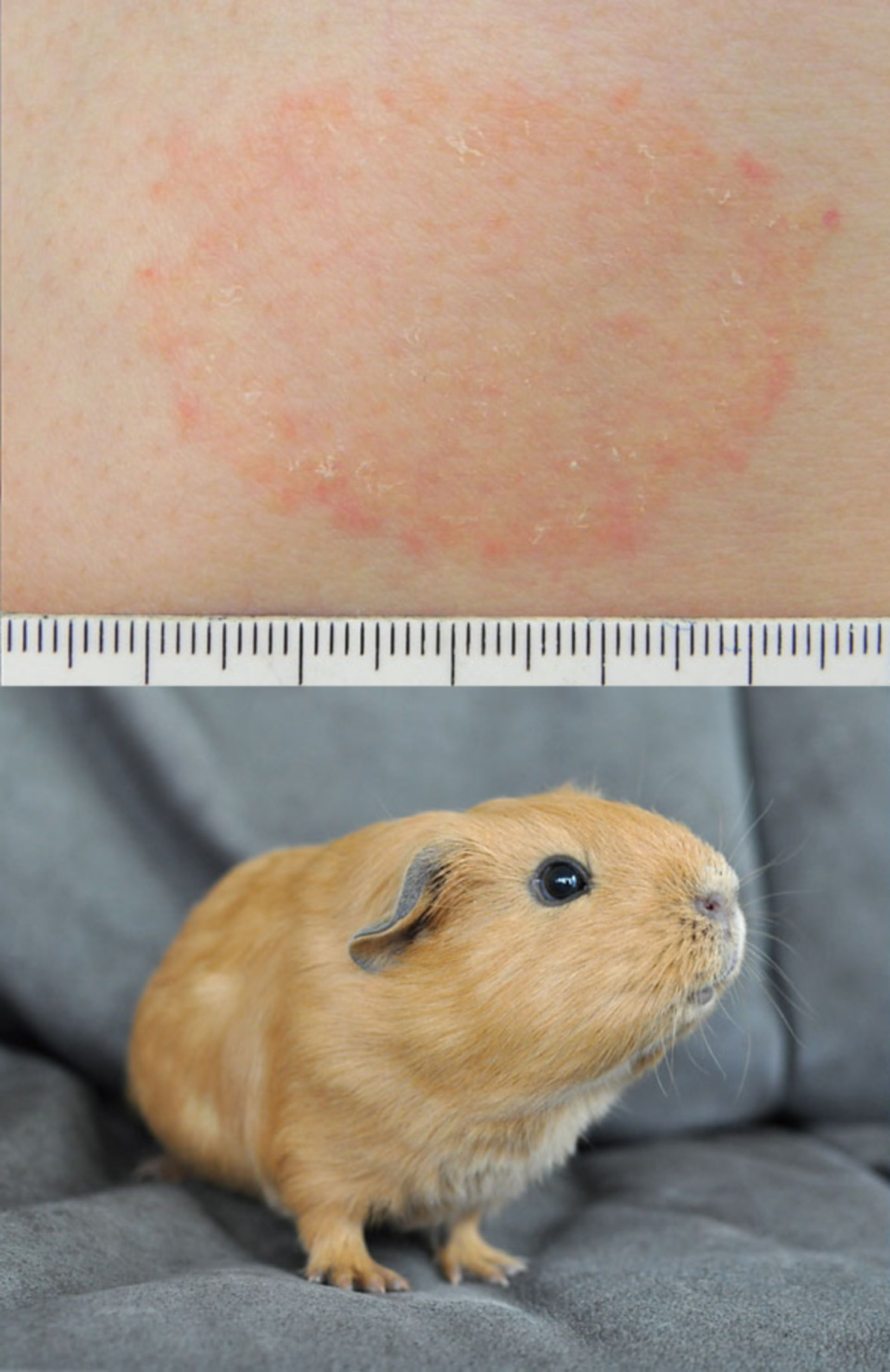 Tinea corporis trasmessi attraverso il contatto con una cavia