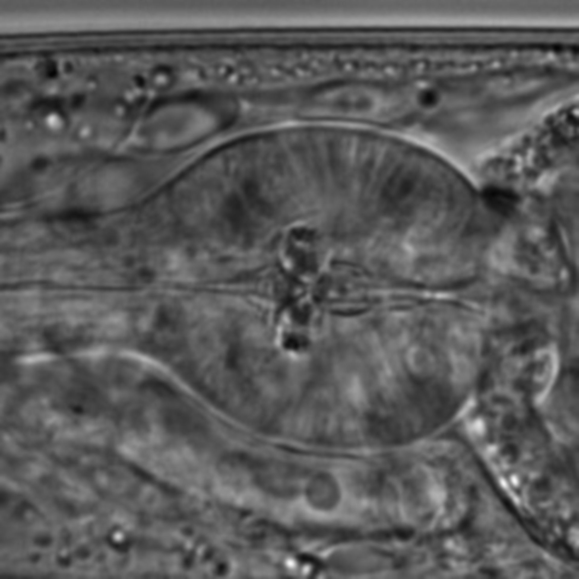 Caenorhabditis elegans - CIL:1595