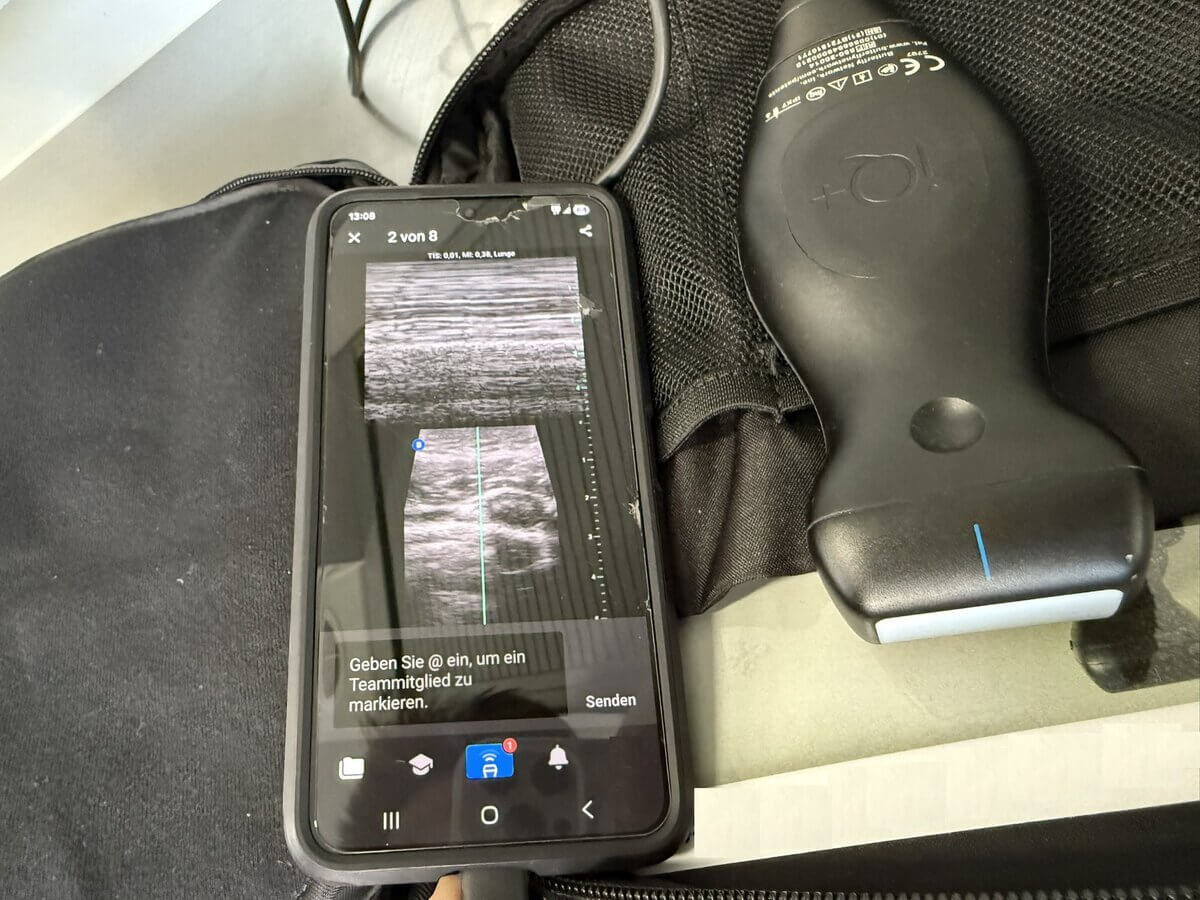 Tragbares mobiles Ultraschallgerät