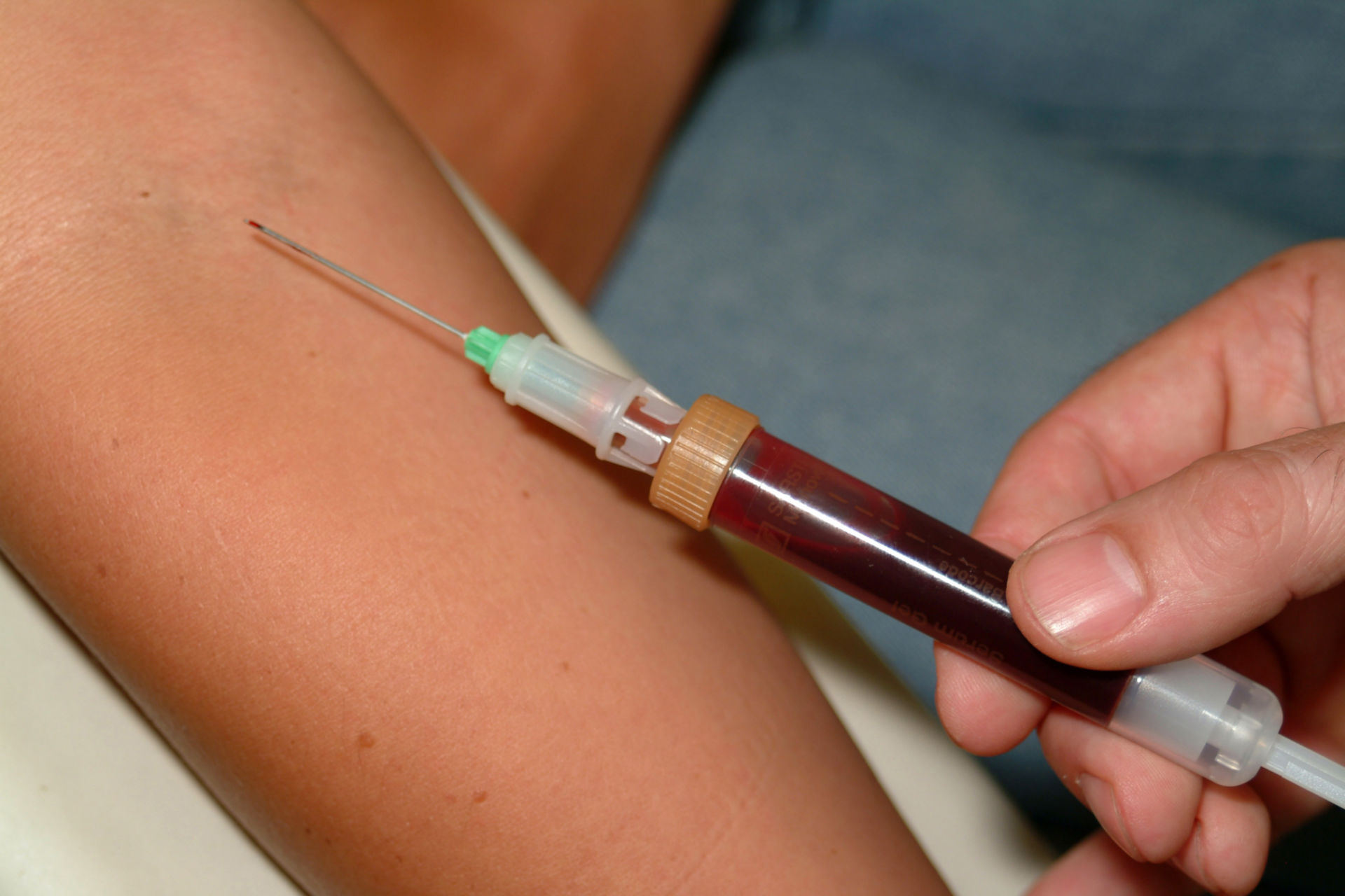 Blood sampling with a cannula