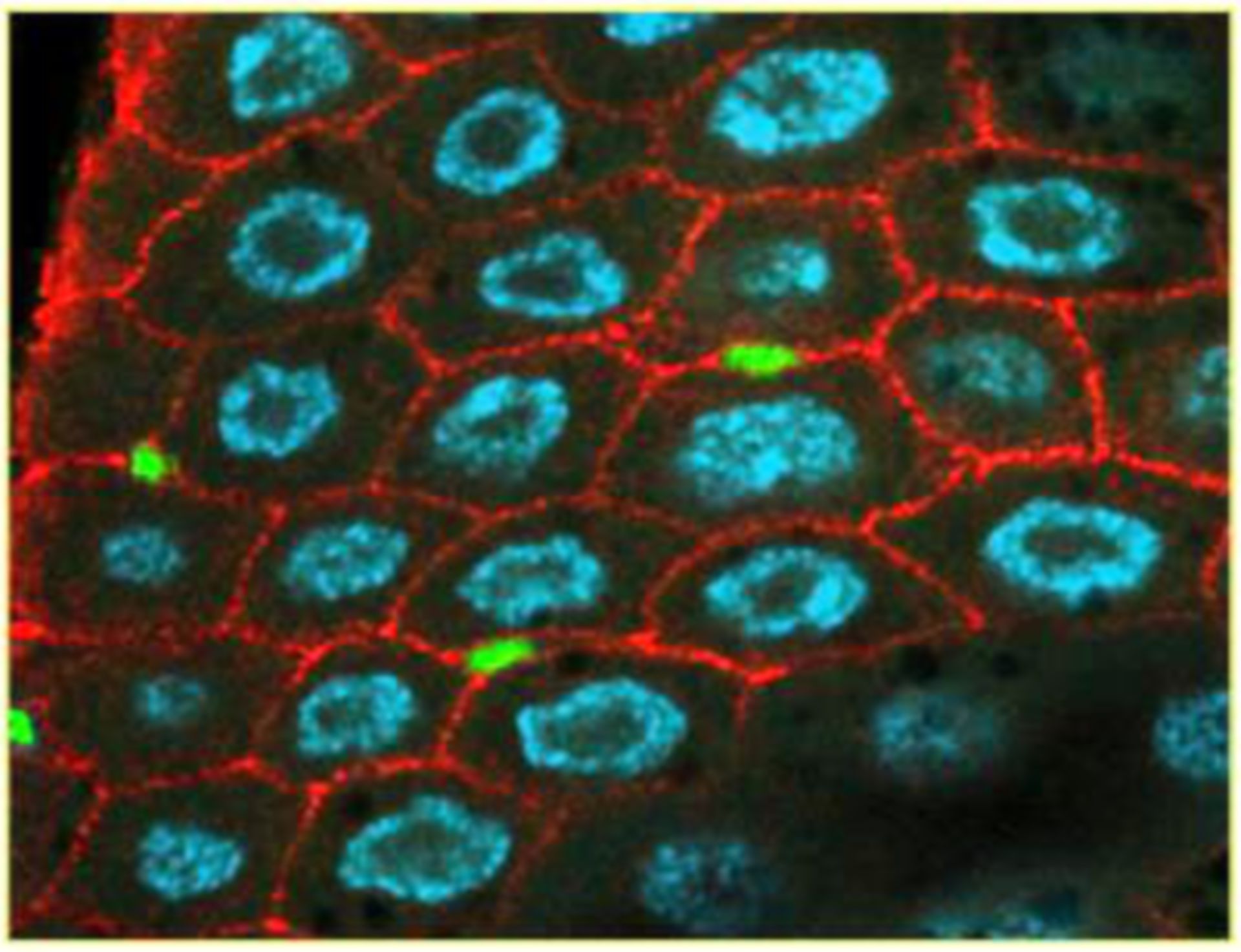 Drosophila melanogaster (membrana celular) - CIL: 39686
