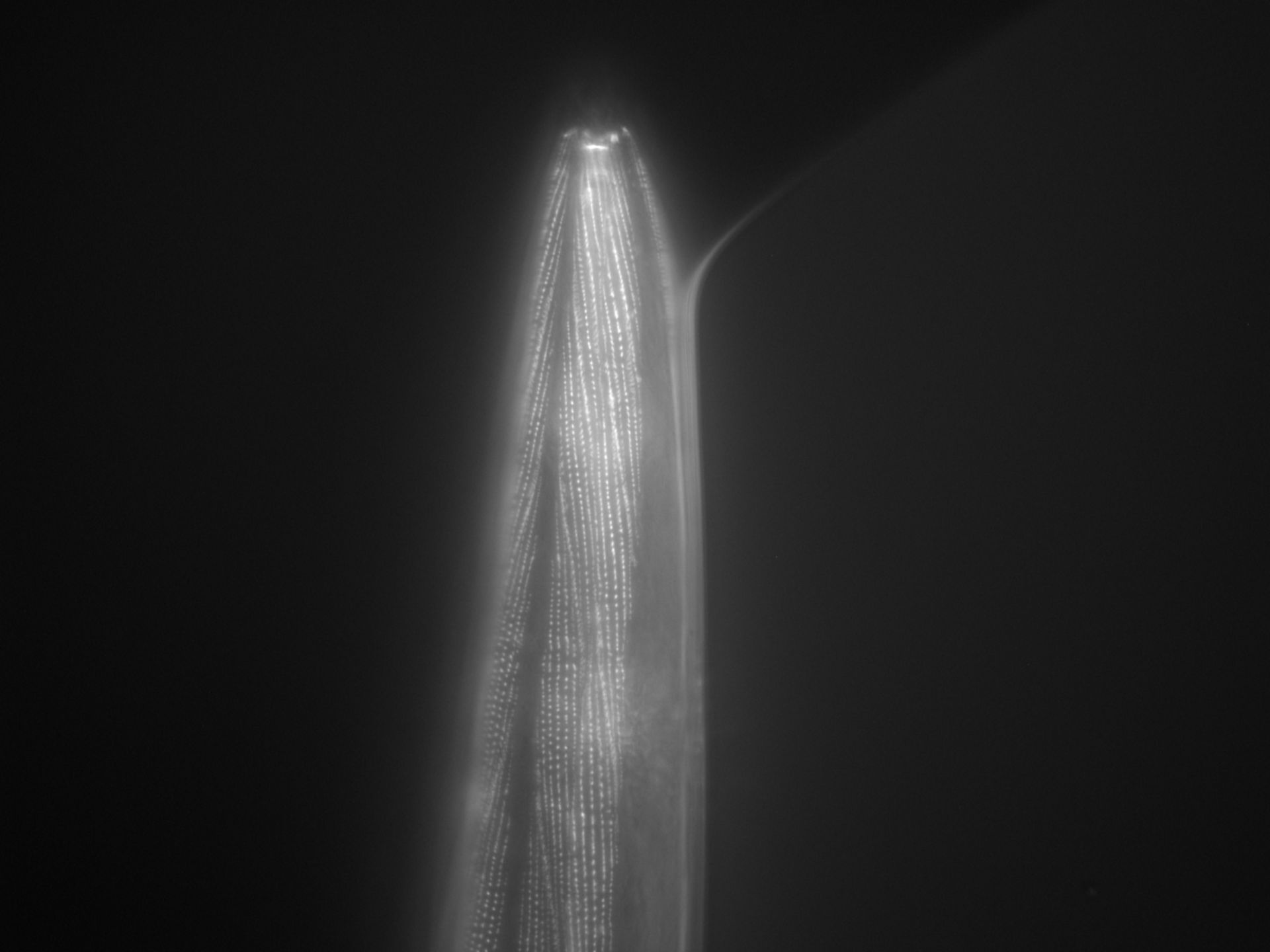 Caenorhabditis elegans (Actin filament) - CIL:1029