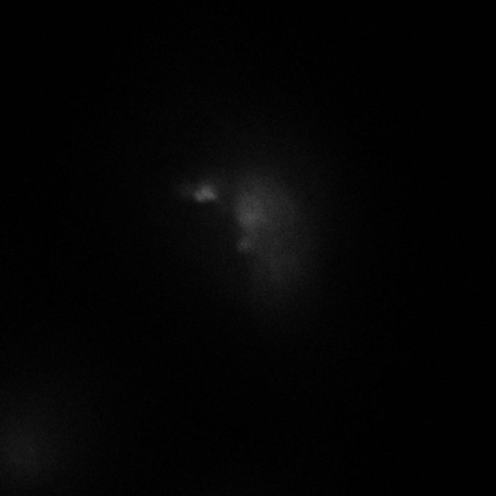 Homo sapiens (Endoplasmic reticulum) - CIL:9196