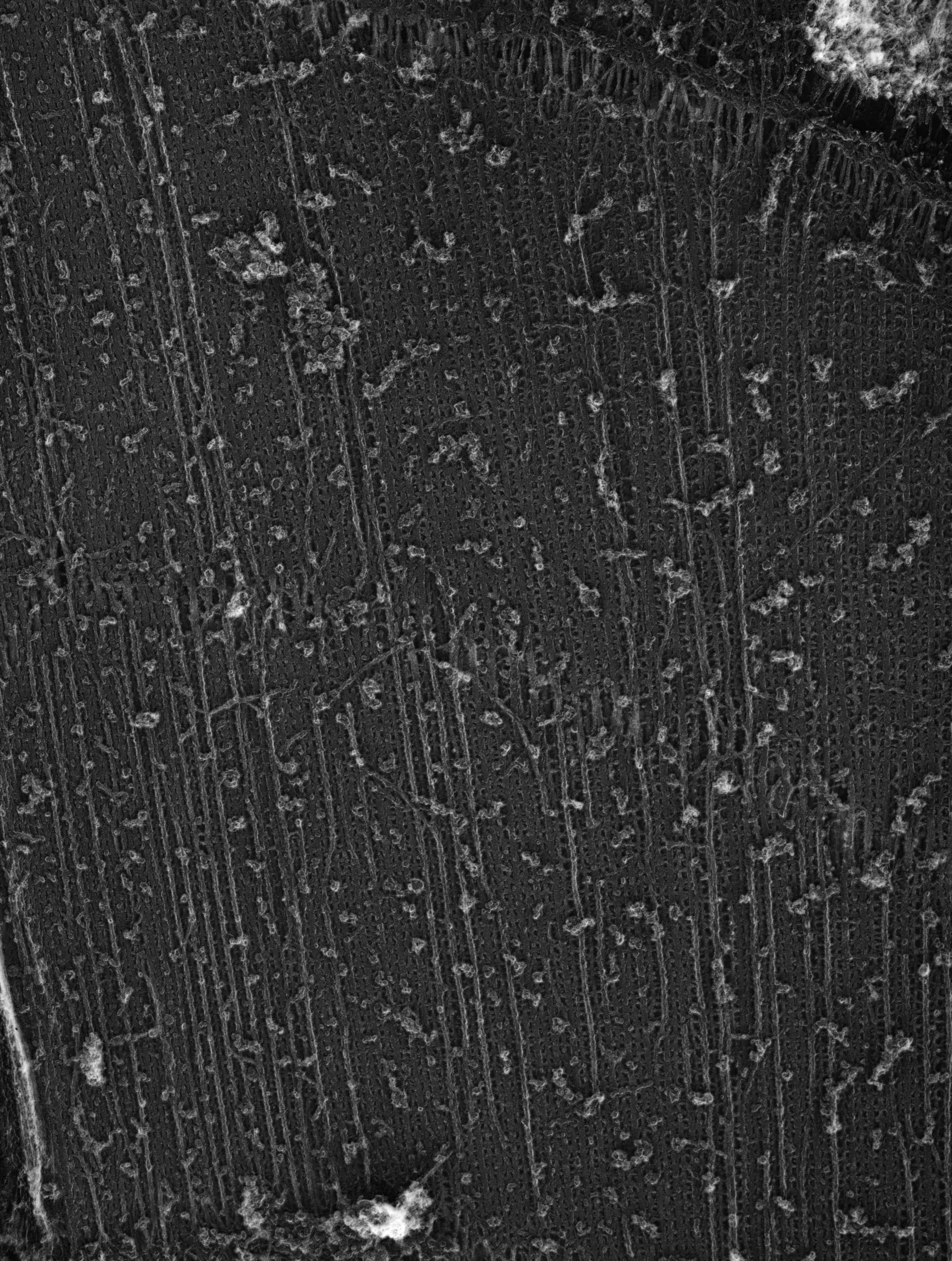 Damselfly (Sarcoplasmic reticulum) - CIL:36092